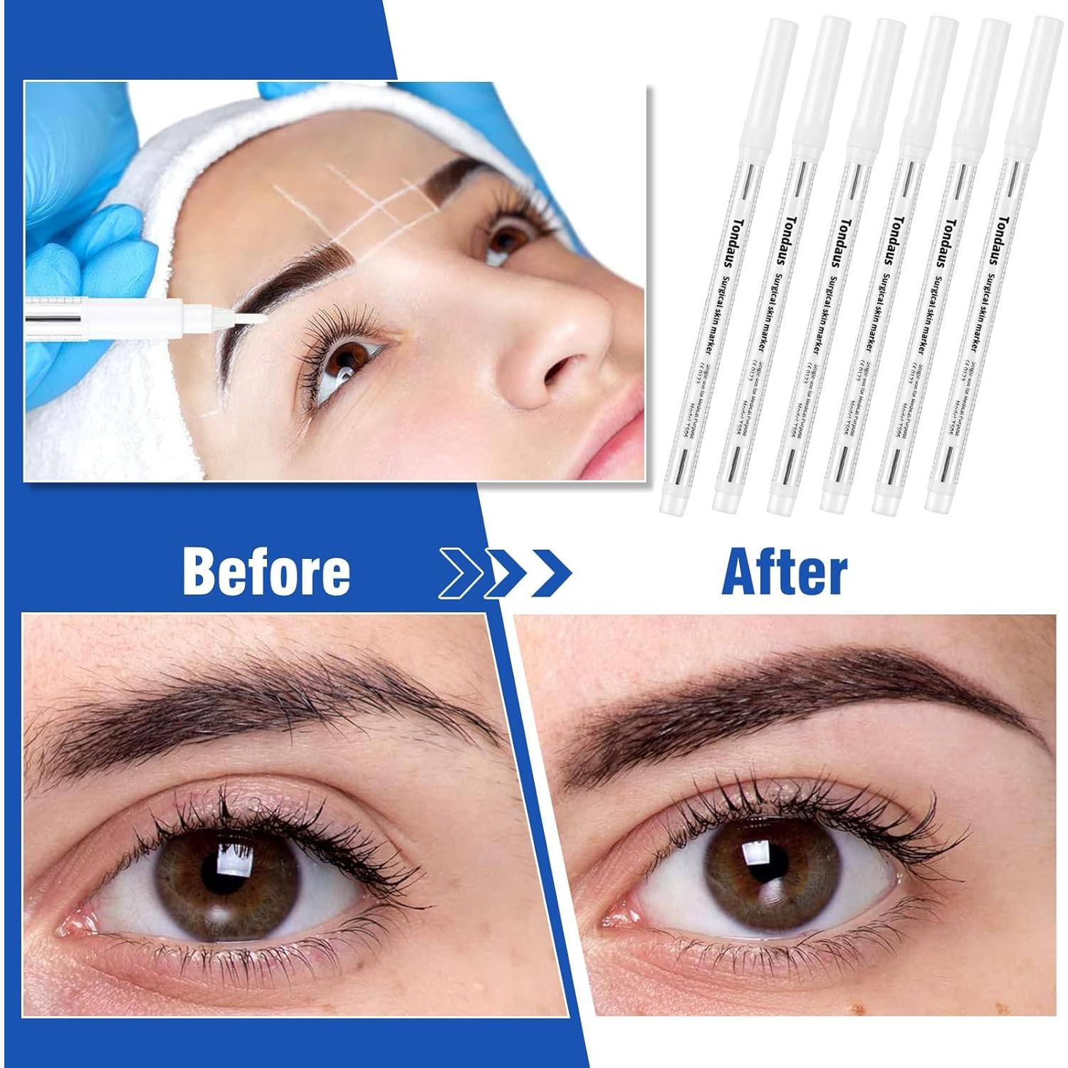 6 Marcadores de Piel Quirúrgicos TONDAUS 1mm Tinta Blanca