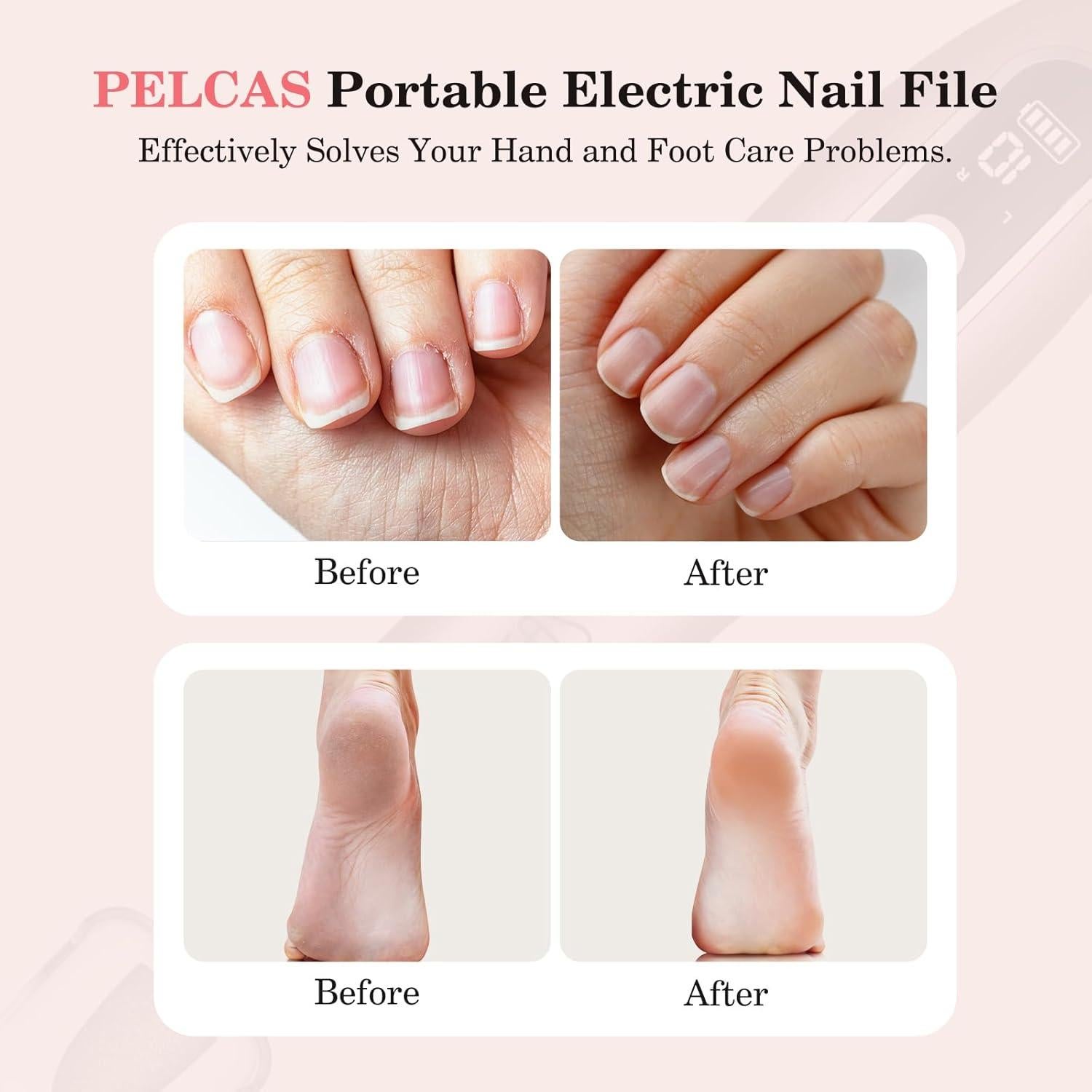 Lima de Uñas Eléctrica PELCAS Rosa, Inalámbrica 10 Velocidades