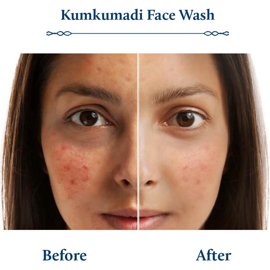 Limpiador Facial Blue Nectar Kumkumadi 100 ml - Antipimienta