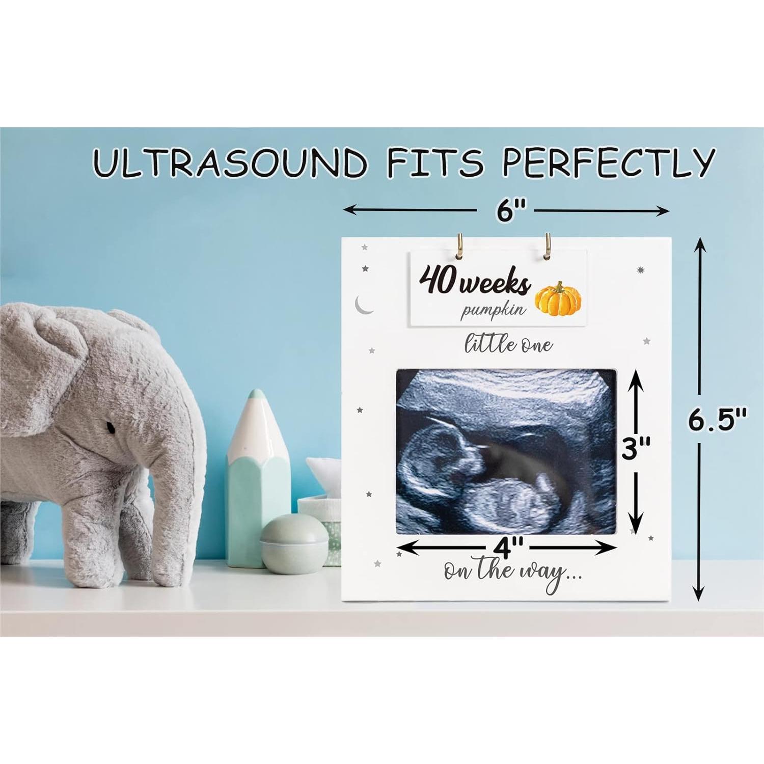 Marco de Ultrasonido BUULUE para Seguimiento del Embarazo