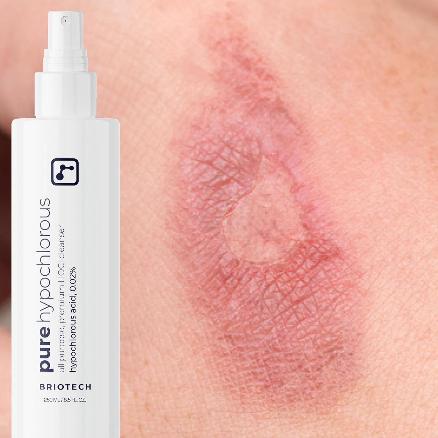 Spray Desinfectante Ácido Hipocloroso Puro Briotech 240 ml