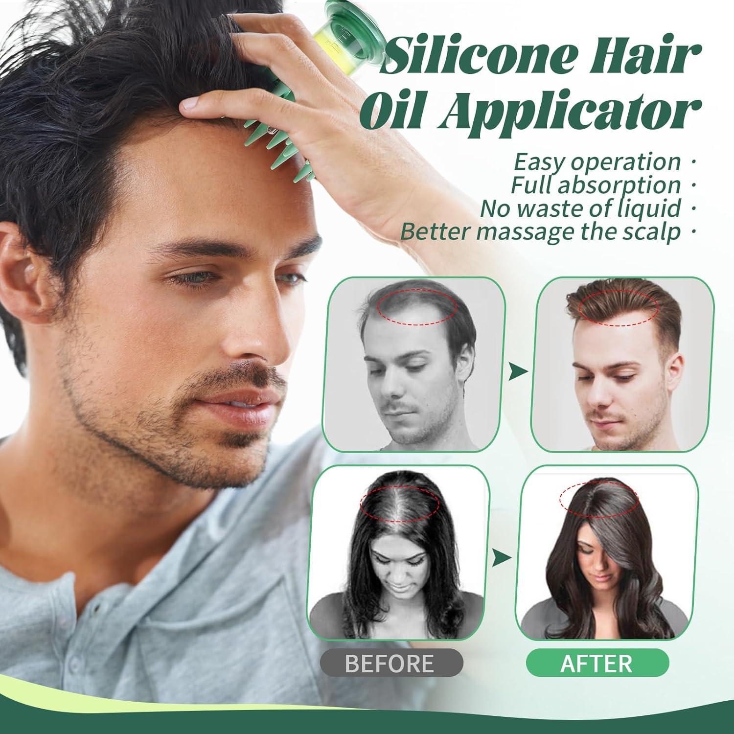 Aplicador de Masaje para Cuero Cabelludo Beautlohas 14ml Silicona