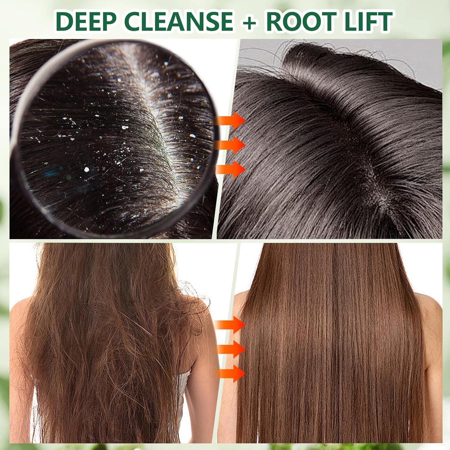 Exfoliante para Cuero Cabelludo GUOYAOLIFU 300g Romero y Menta