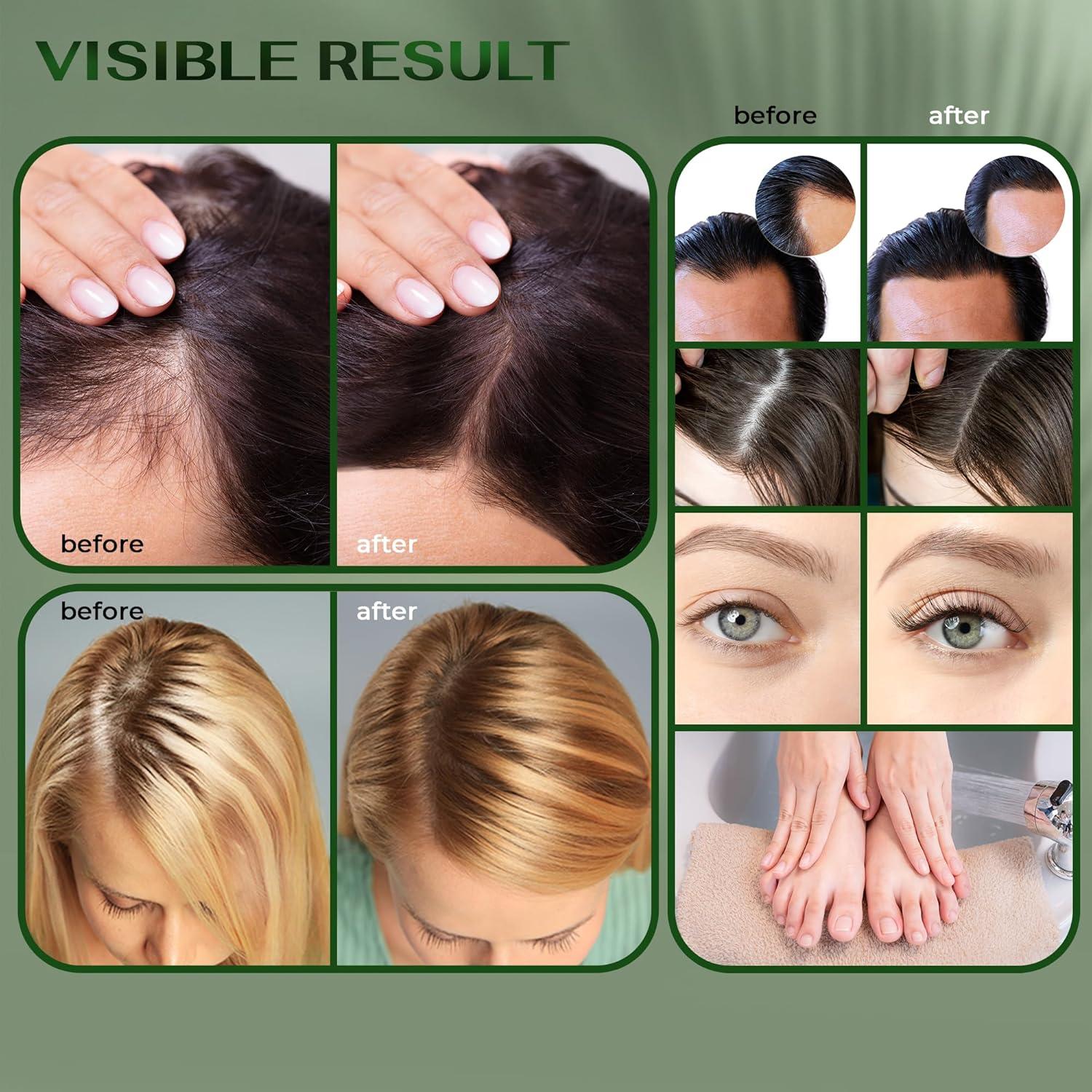 Aceite de Batana y Romero BrightJungle 118 ml - Crecimiento Cabello