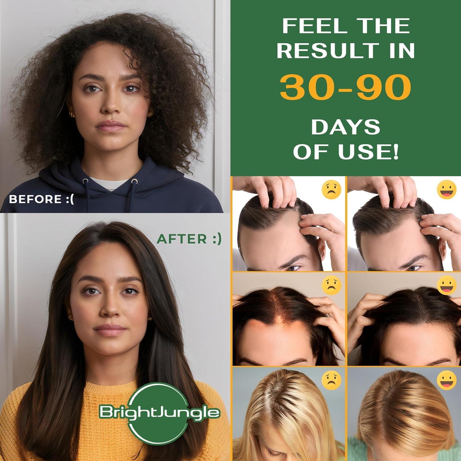 Aceite de Batana y Romero BrightJungle 118 ml - Crecimiento Cabello