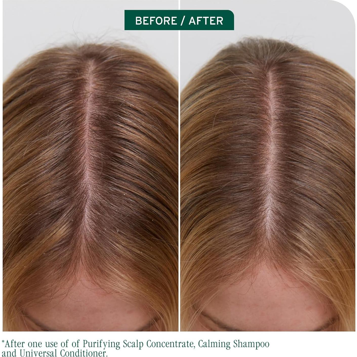 Biolage Scalp Sync Tratamiento Exfoliante 192g - Purificante