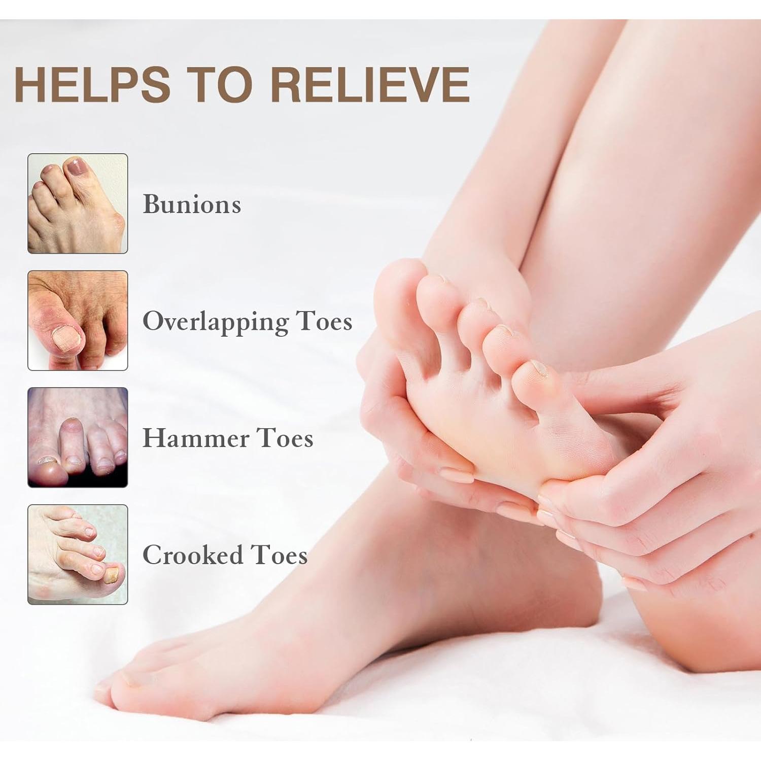 Separadores de Dedos HLOES para Juanetes y Fascitis Plantar