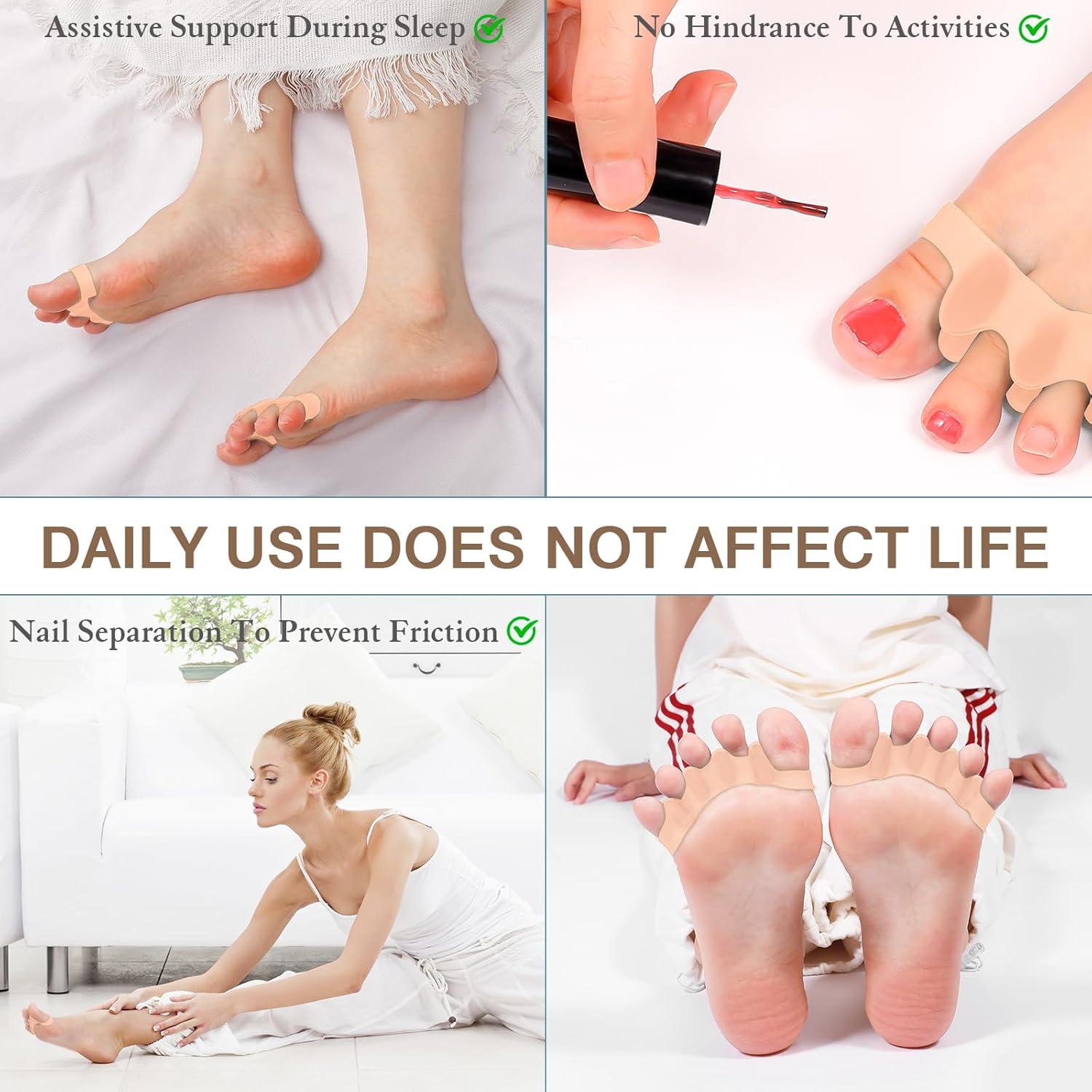 Separadores de Dedos HLOES para Juanetes y Fascitis Plantar