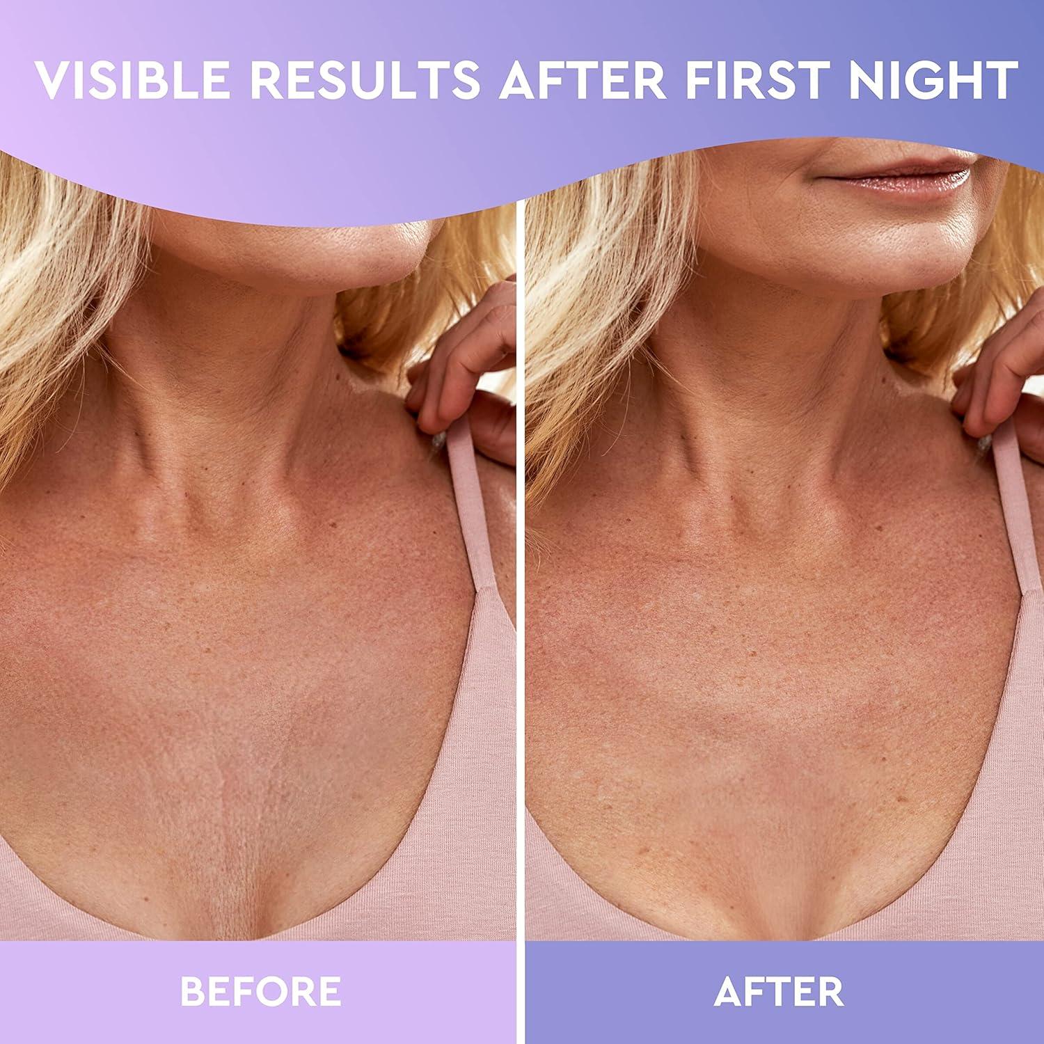 Parches de Silicona para Arrugas en el Escote CLEVERFY - 4 Parches Reutilizables