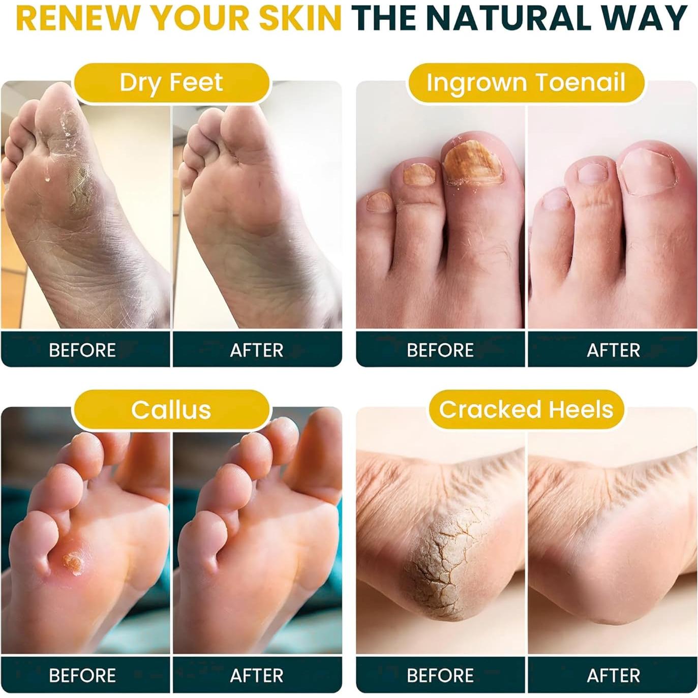 Remojo de Pies Foot Cure 0.45 kg - Árbol de Té y Cítricos