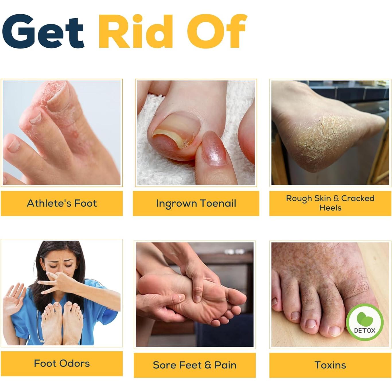 Remojo de Pies Foot Cure 0.45 kg - Árbol de Té y Cítricos