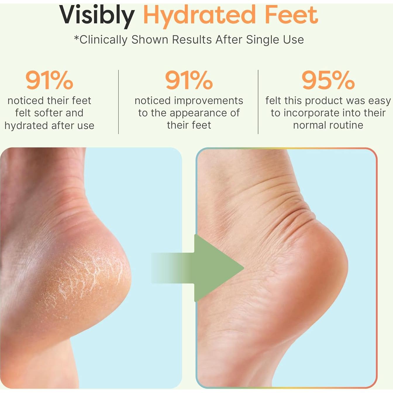 Calcetines Hidratantes ZenToes para Talones Agrietados - Regular