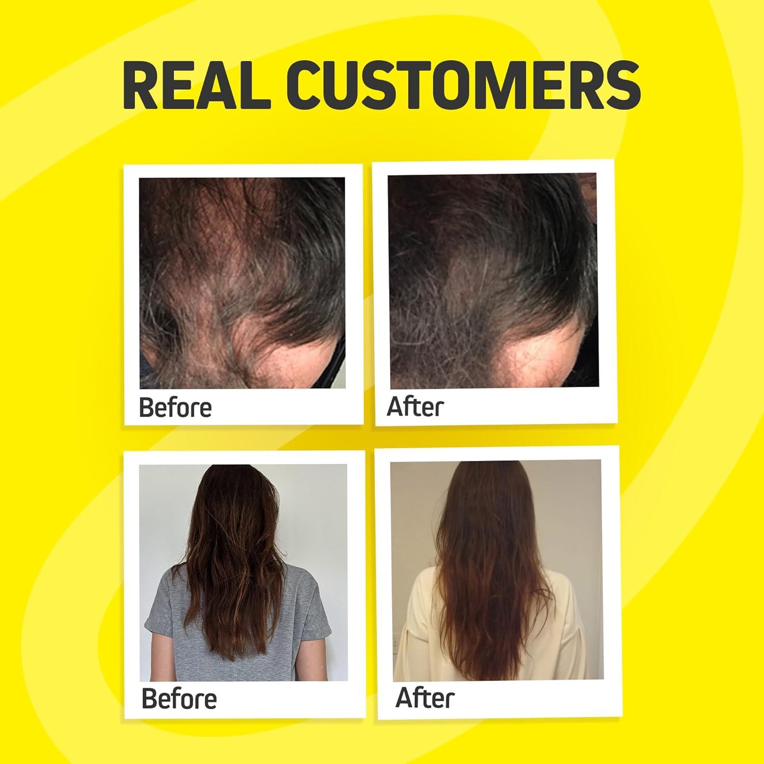 Suplemento de Crecimiento Capilar Foli Tonic 60 Cápsulas Veganas