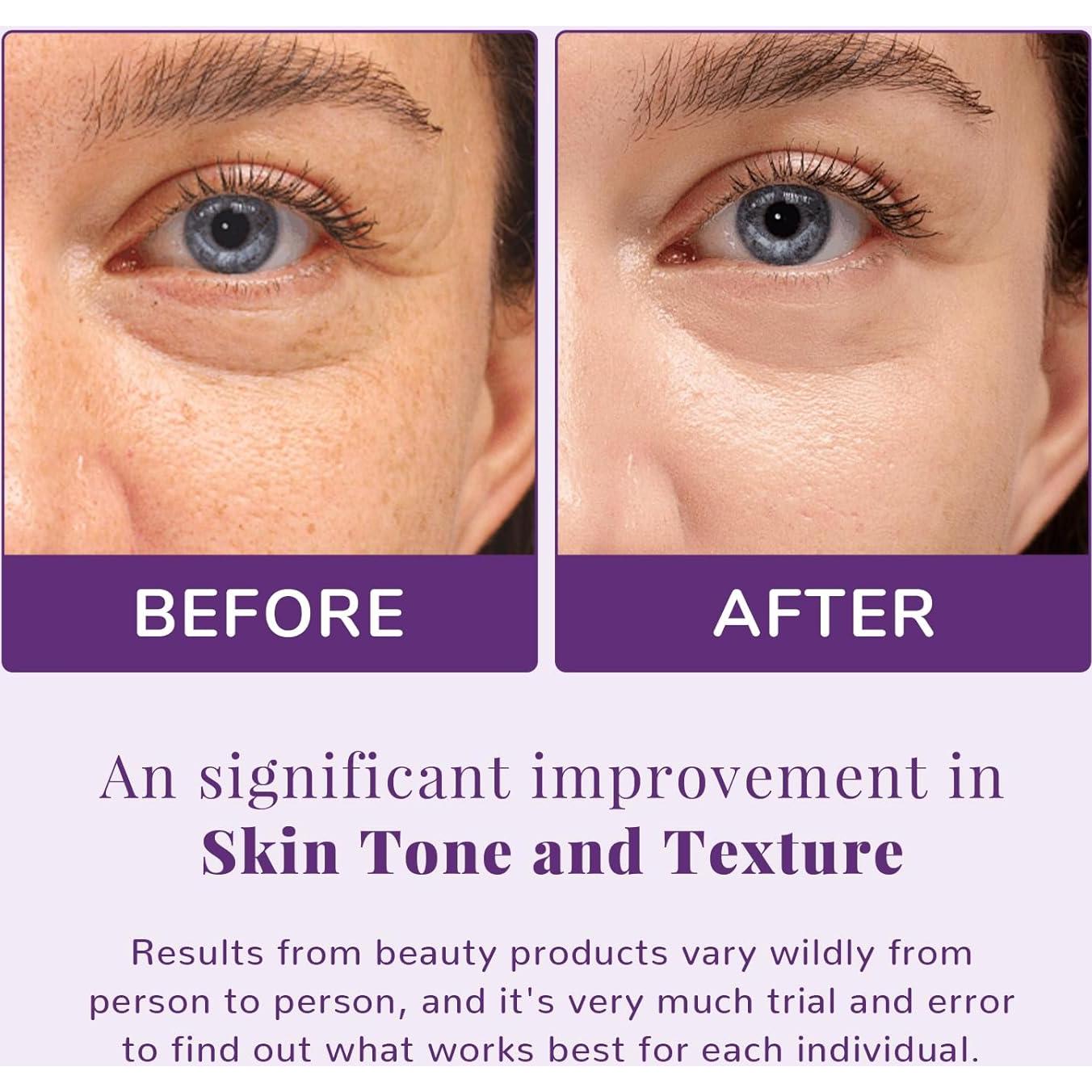 Almohadillas Faciales ANAI RUI Niacinamida 50 Unidades