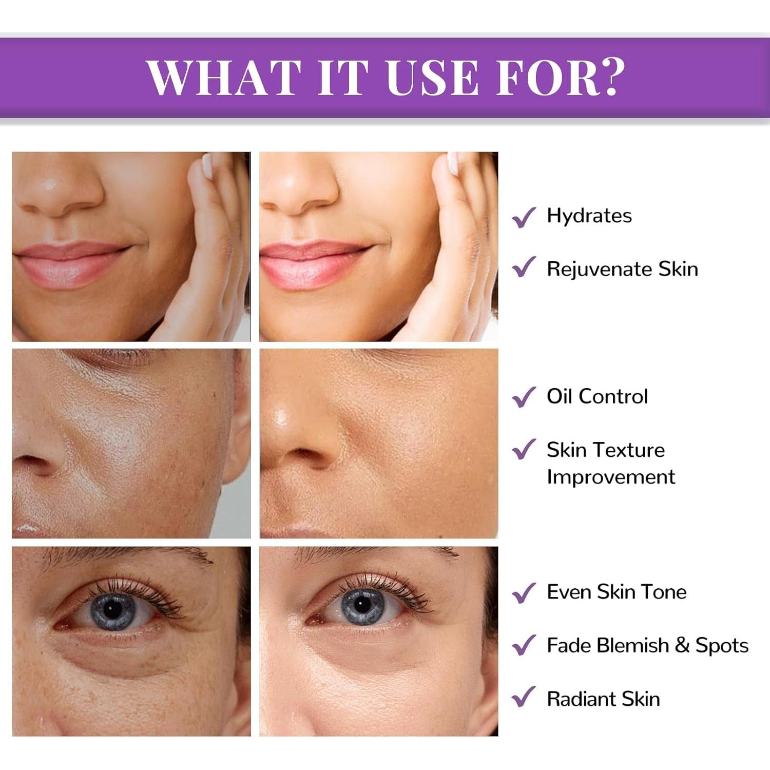 Almohadillas Faciales ANAI RUI Niacinamida 50 Unidades