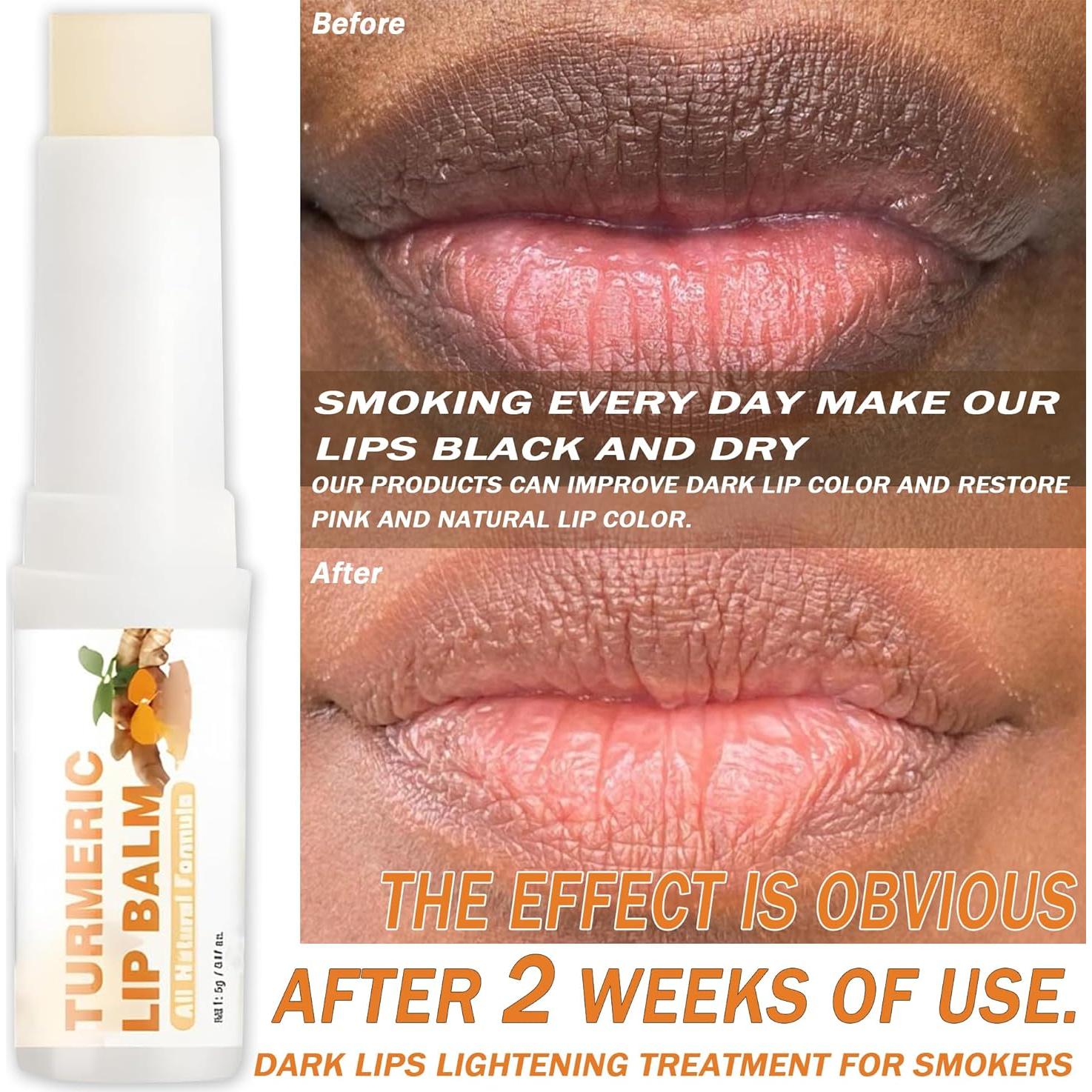 Bálsamo Labial de Cúrcuma LoisAAA 4.8g Aclarador Hidratante