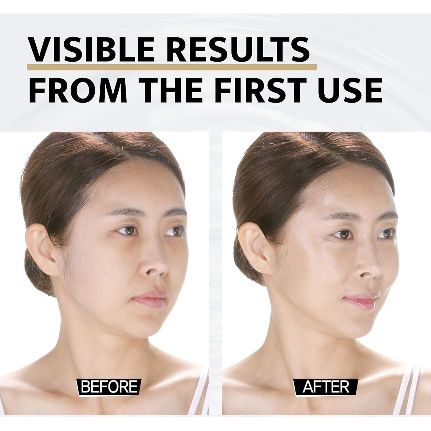 Mascarilla de Silicona Miz Herb para Doble Mentón y Arrugas