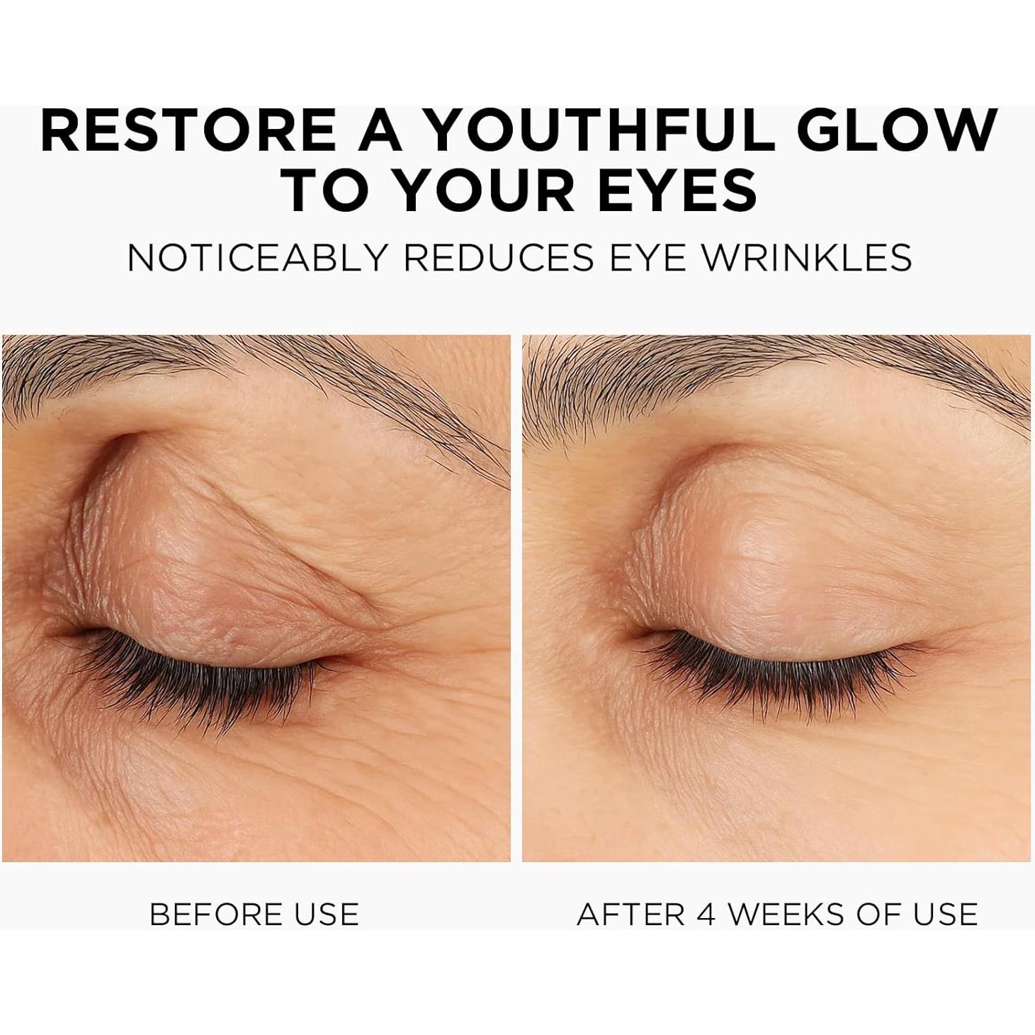 Crema para Ojos Momohoo con Retinol y Colágeno 20ml