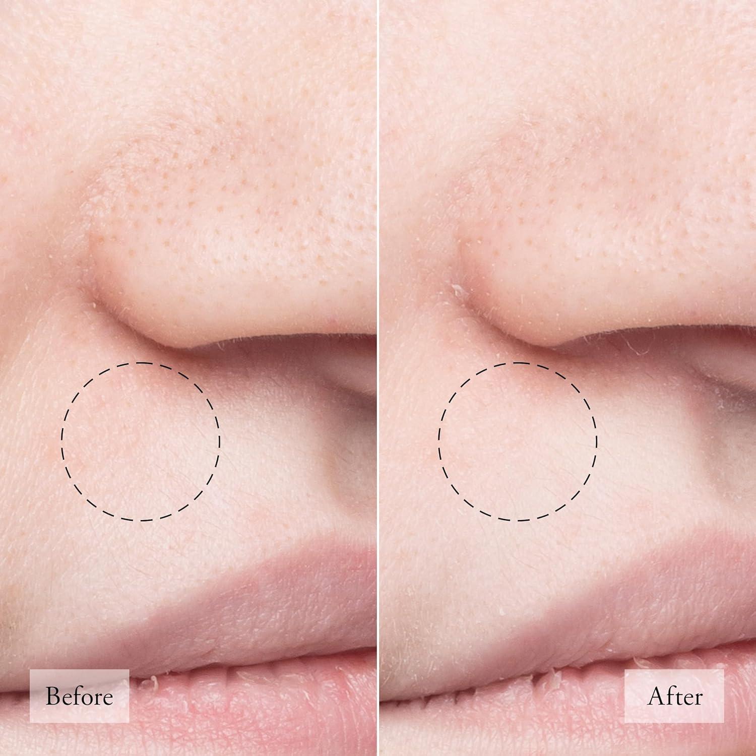 Limpiador Facial Philosophy Pureza Hecha Simple 125g Set 3 Piezas