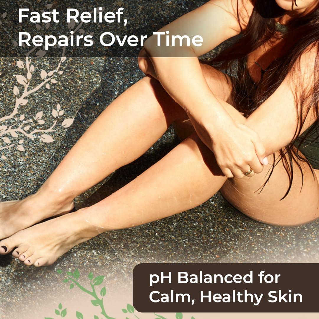 Crema Hidratante para Eczema y Psoriasis Wild Naturals 113g