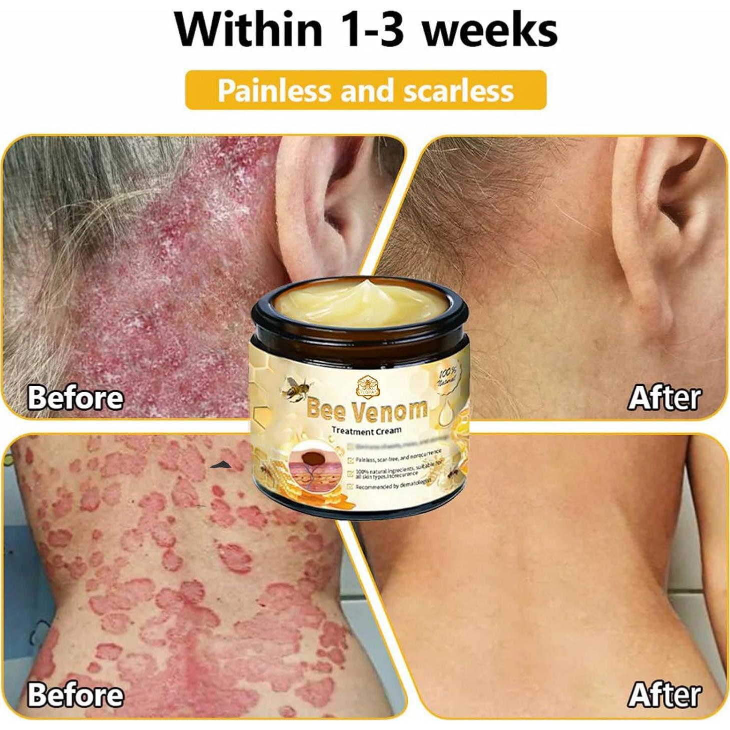 Crema Tratamiento Piel con Veneno de Abeja Luhaka 40g