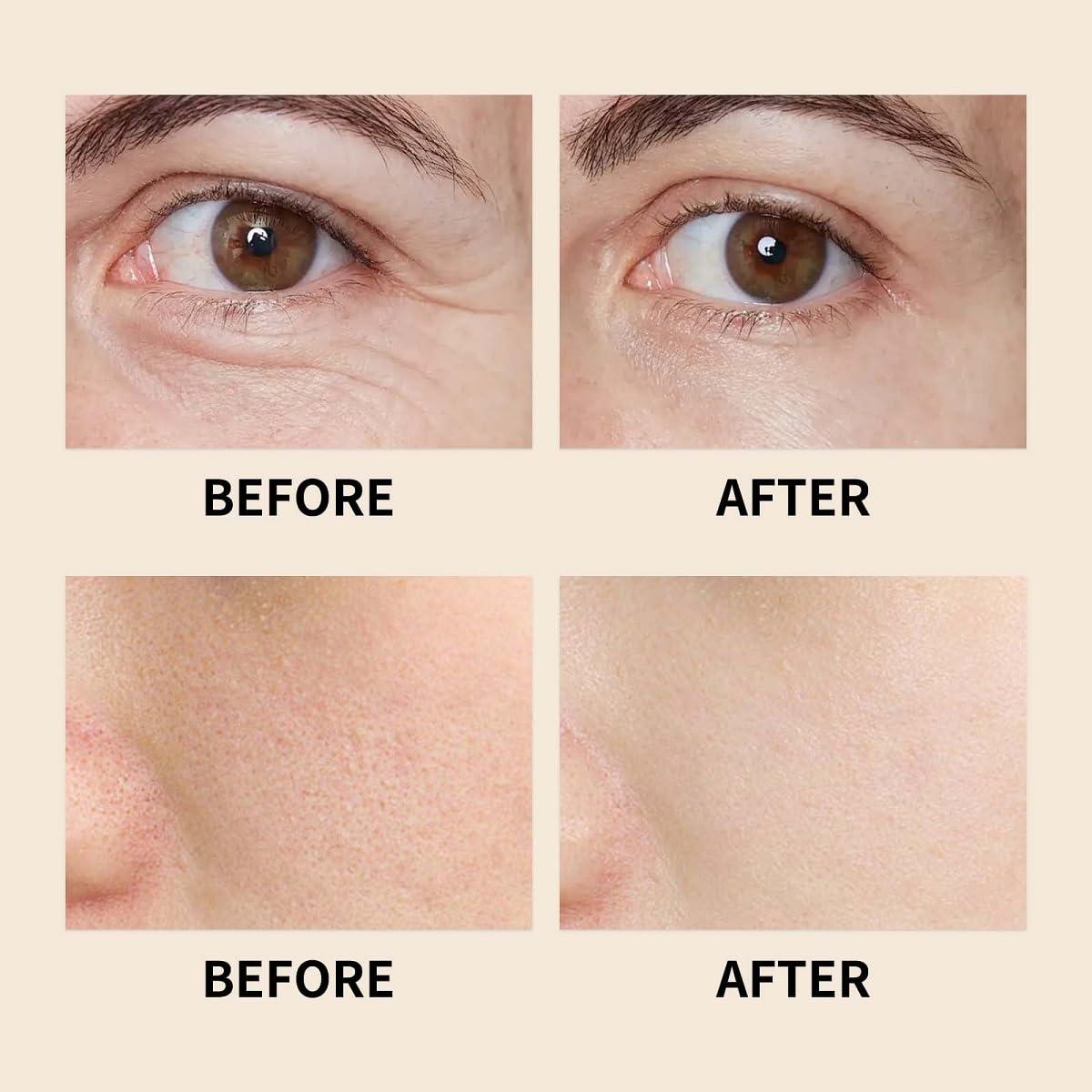 30 ML Aceite Esencial de Incienso MULPG Hidratante Facial Natural