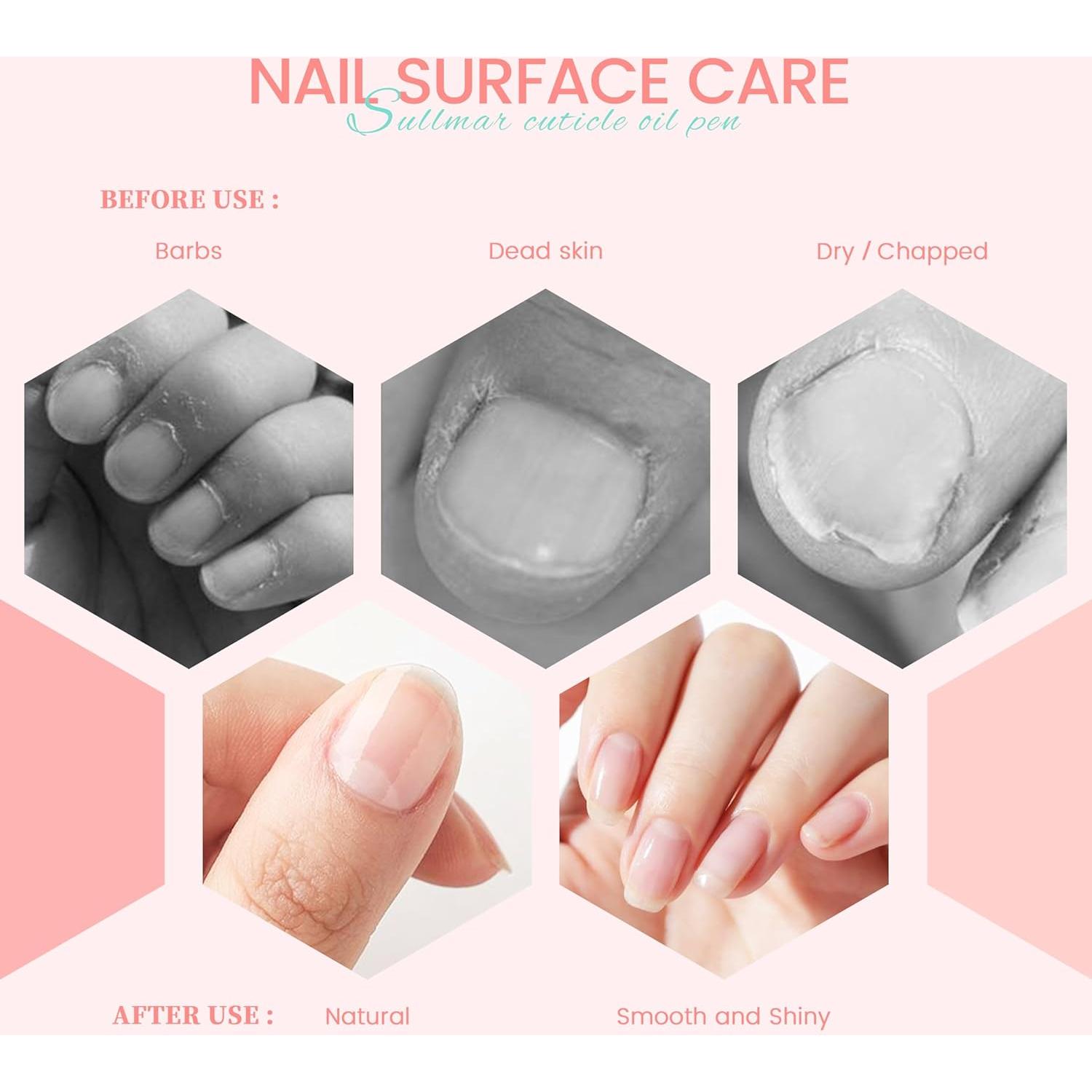 Set de Bolígrafos de Aceite para Cutículas SULLMAR - 5pcs