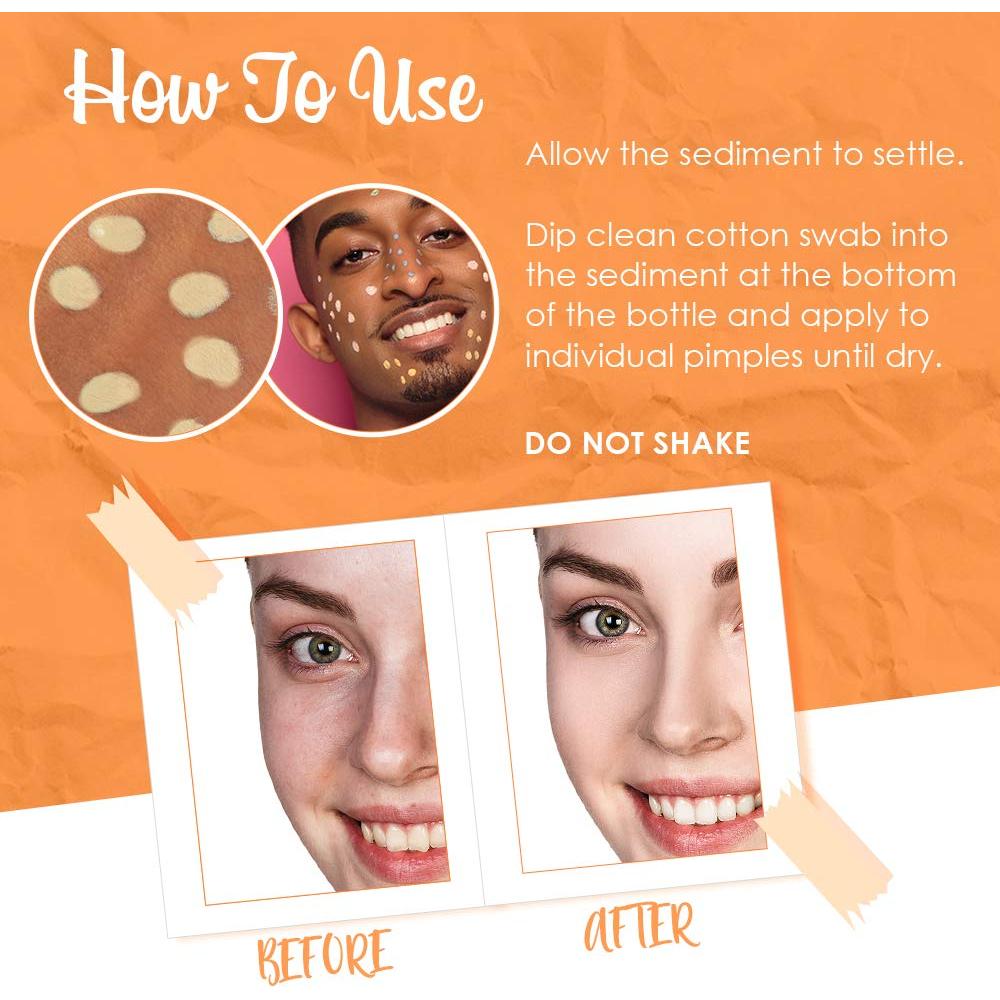 Loción Aclarante Bye Bye Blemish Vitamina C 29.57 ml