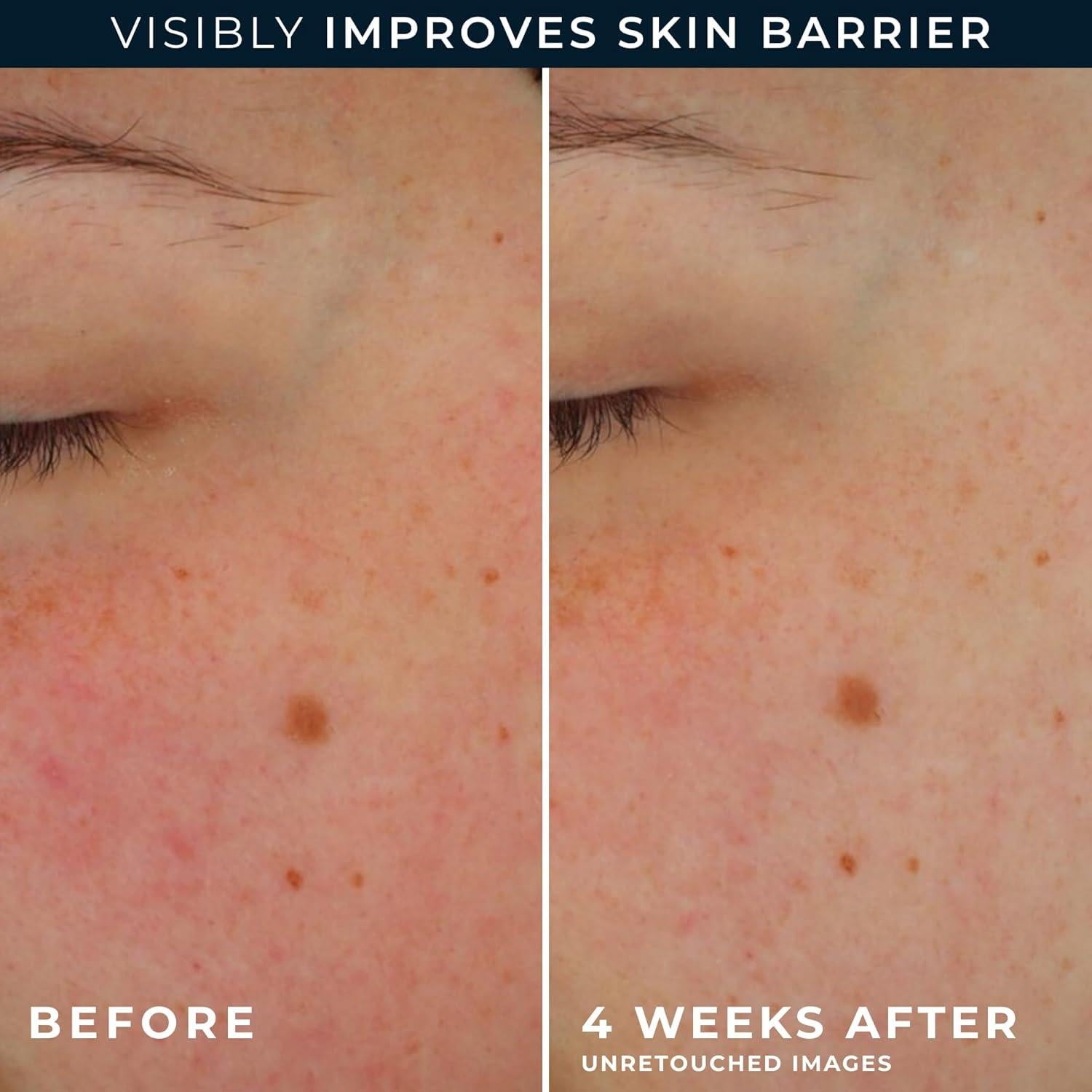 Crema de Día RoC Barrier Renew SPF 30 Hidratante 70.87 g