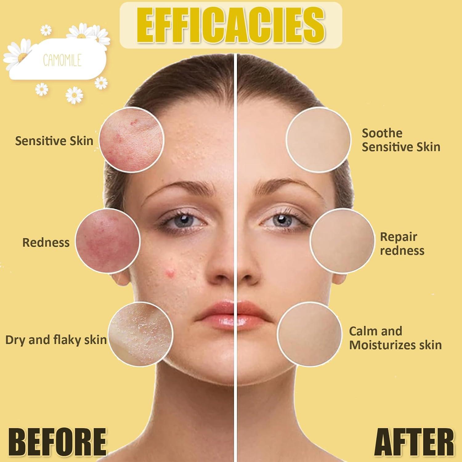 Mascarilla de Gel YMEYFAN de Manzanilla 28g - Hidratante y Reparadora