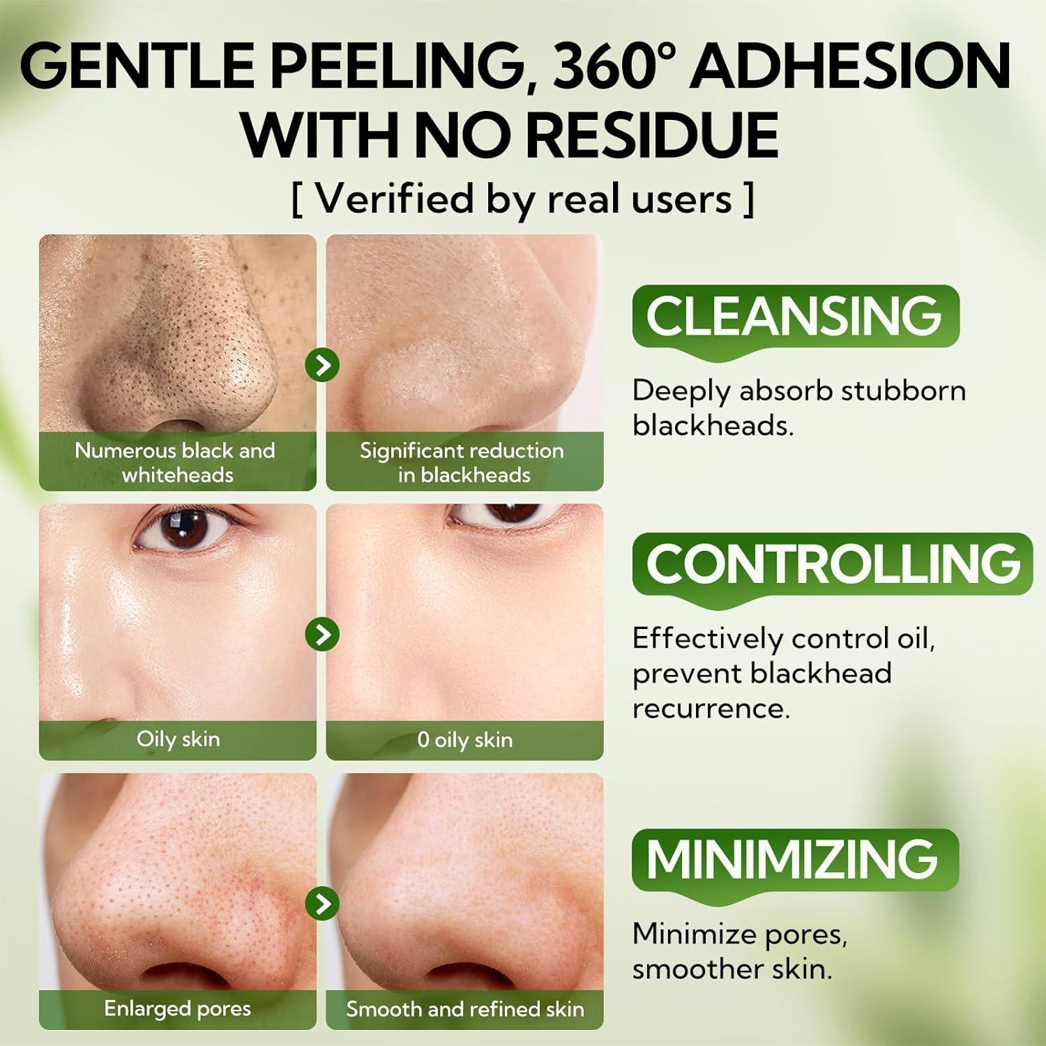 Tiras de Poro LANBENA 3.0 Carbón de Bambú - Limpieza Facial