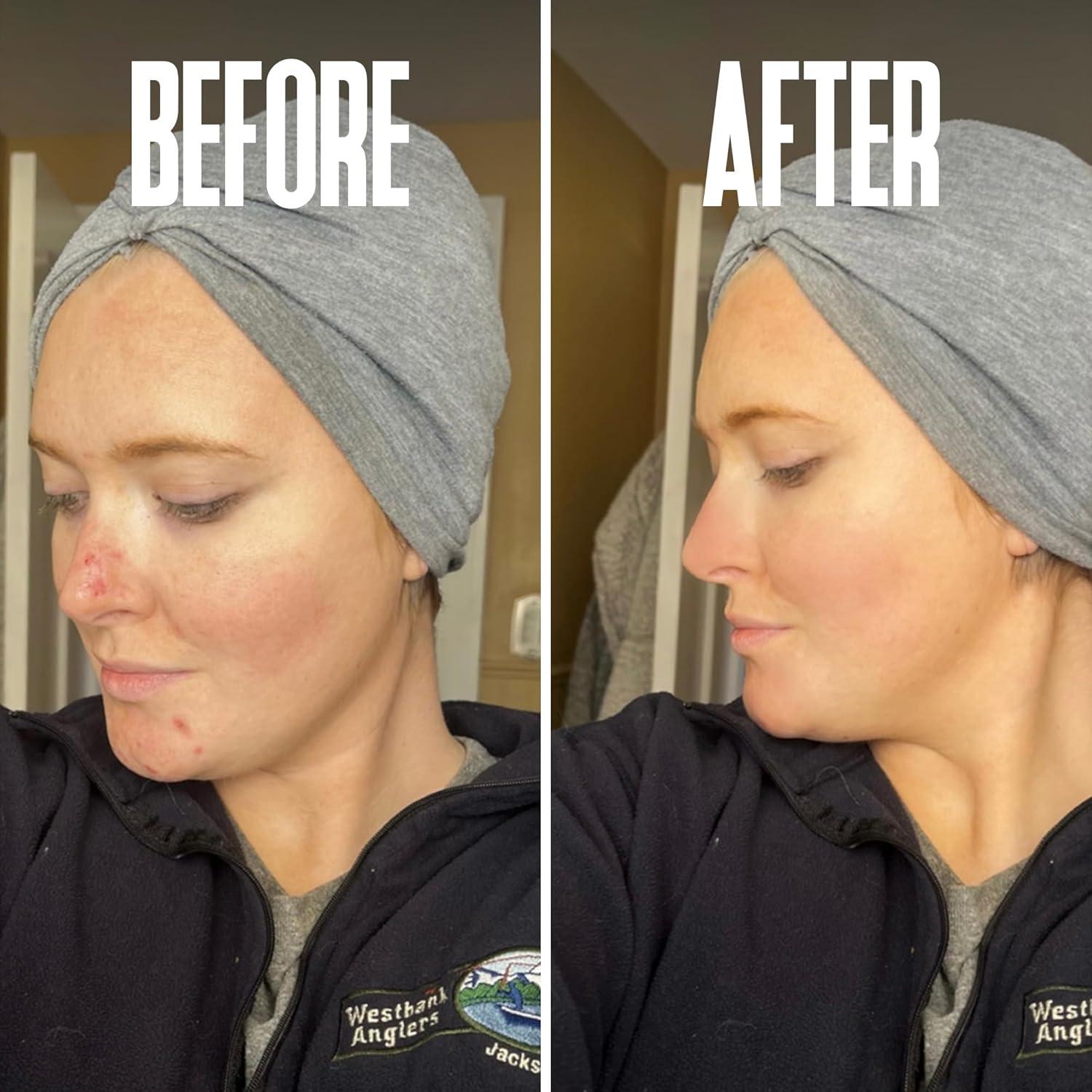 Peeling Químico Glicólico 40% Beautiste 30 ml - Exfoliante Facial