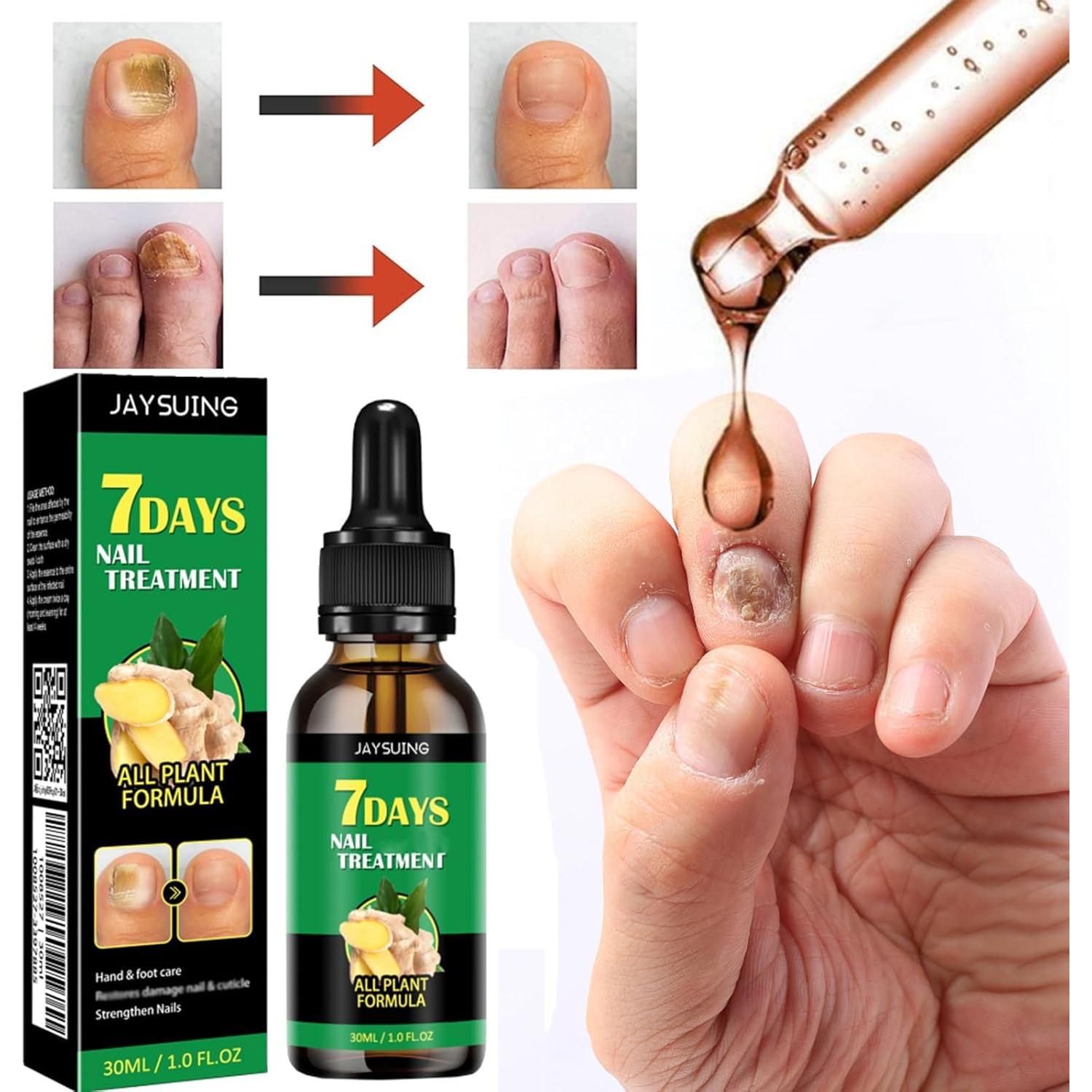 Suero de Crecimiento de Uñas de Jengibre 29.57 ml - Cuidado Cutículas