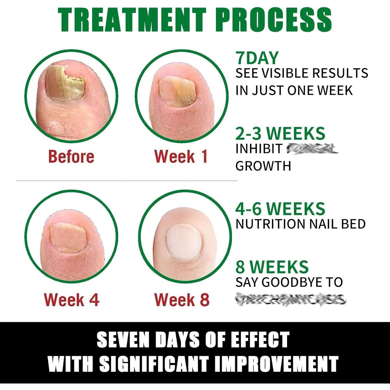 Suero de Crecimiento de Uñas de Jengibre 29.57 ml - Cuidado Cutículas