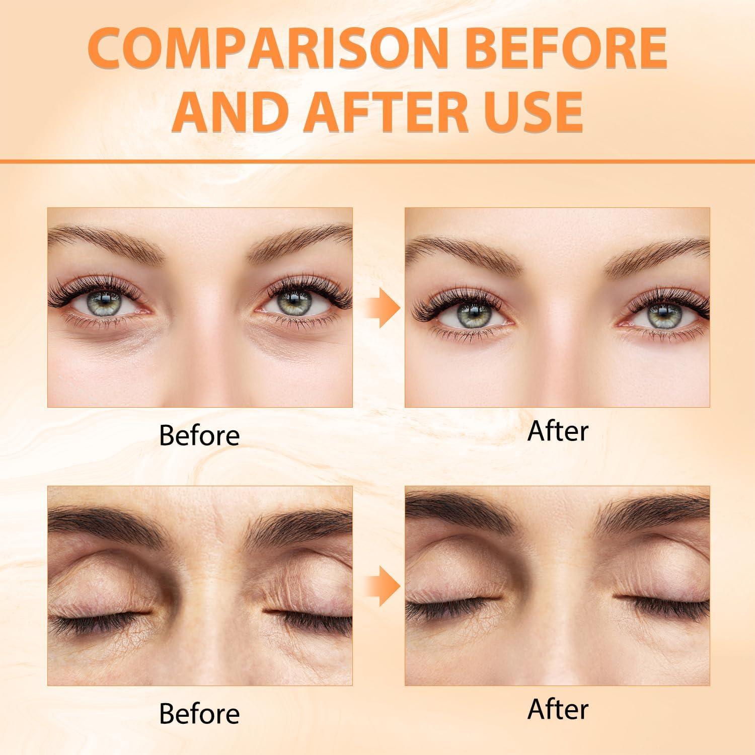 Bálsamo para Ojos REATIFUL 2pcs con Vitamina C - Reductor de Ojeras