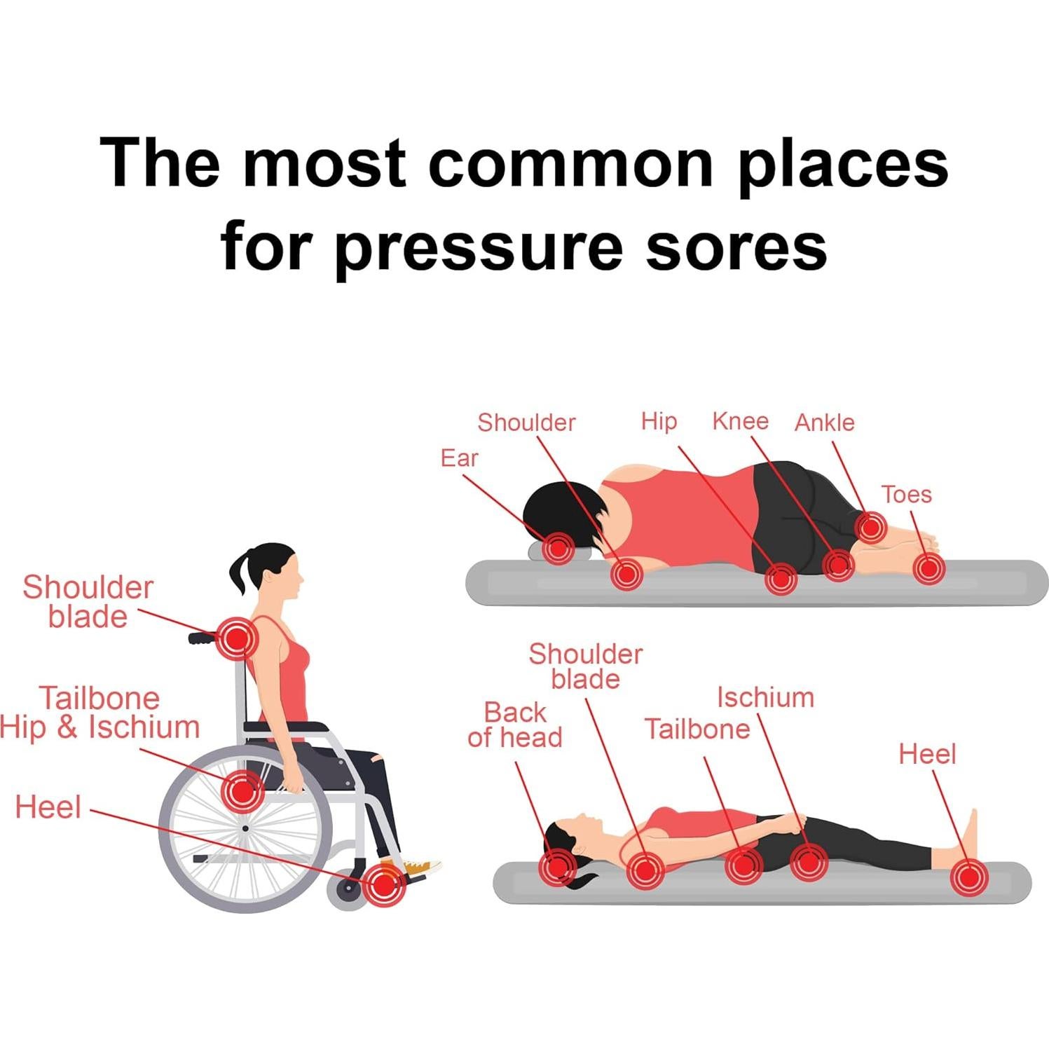 Crema Sanadora TriDerma MD 113 g para Úlceras por Presión