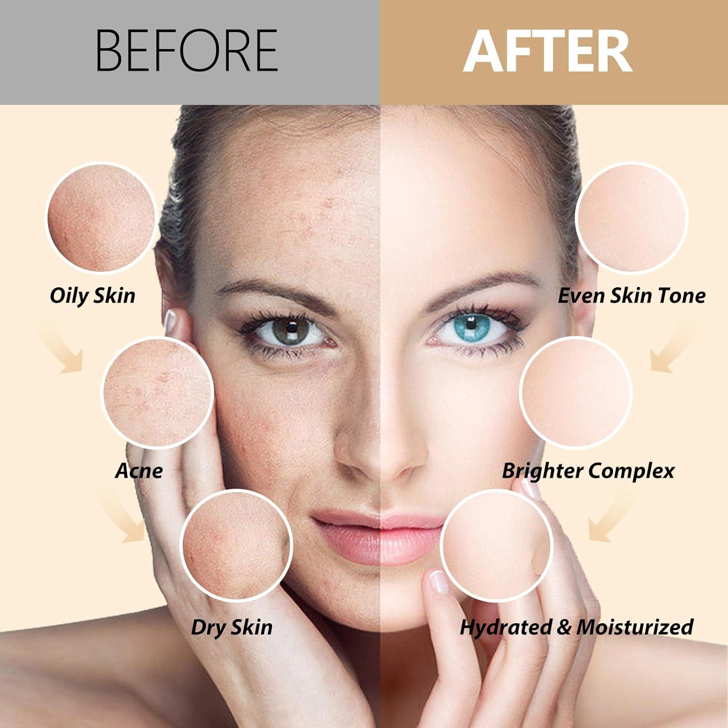 Mascarilla Facial de Gel Hidratante Fokiabin 23 Oz 24K