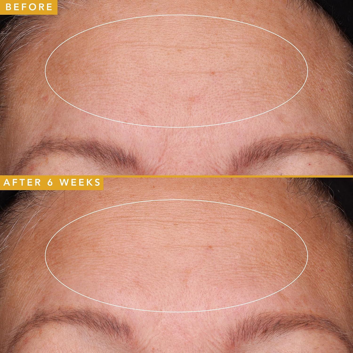 Suero Facial Anti Envejecimiento Farmacia Belleza 5ml