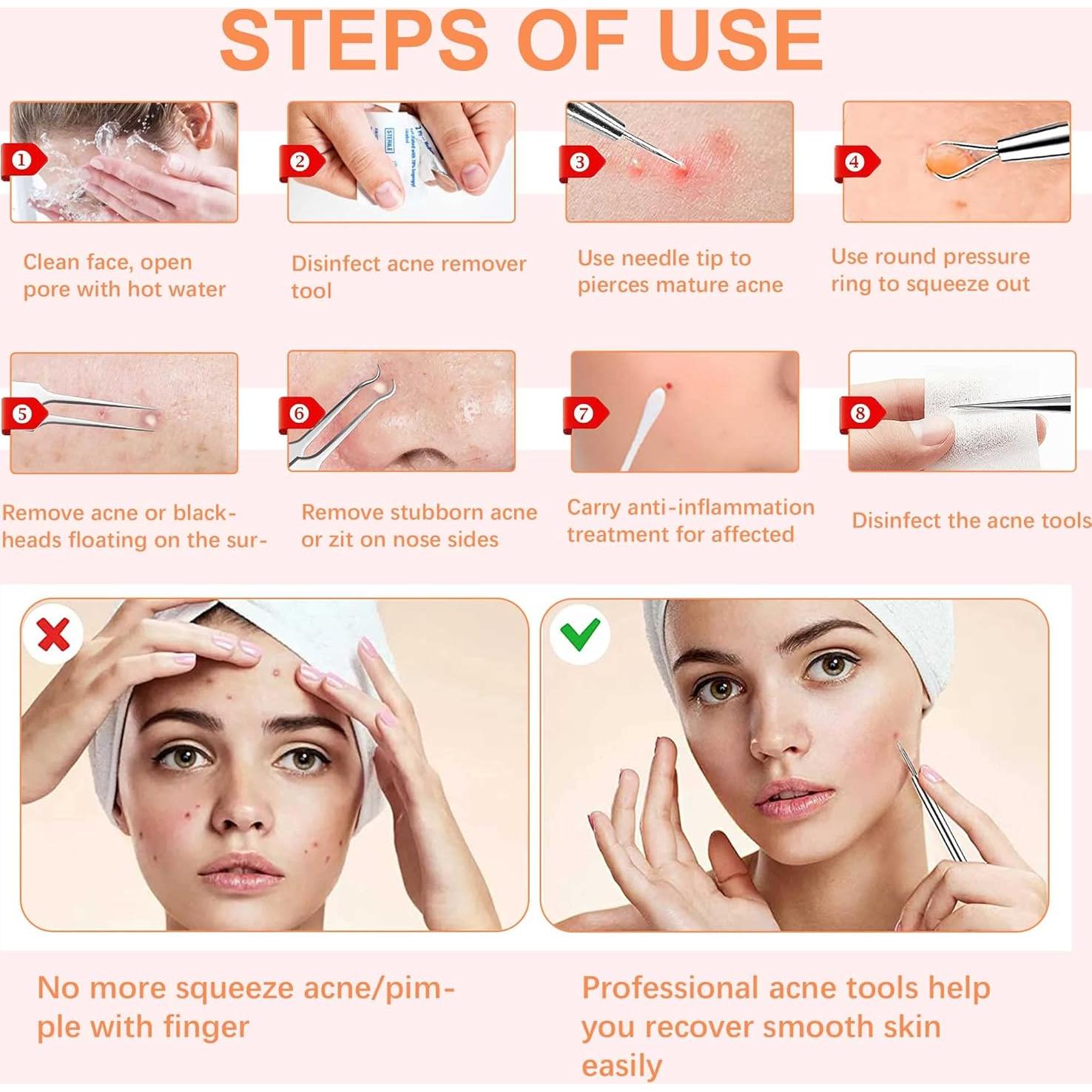 Kit de Pinzas WSYUB para Puntos Negros y Vello Encarnado