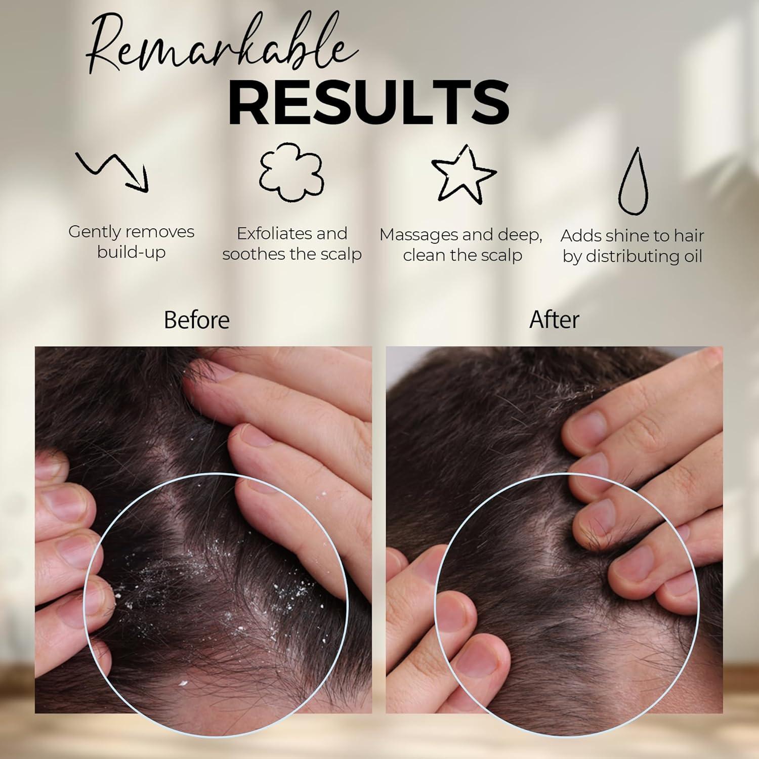 Cepillo Masajeador de Cuero Cabelludo Fiora Naturals Rosa - Exfoliador de Silicona para Caspa y Crecimiento del Cabello