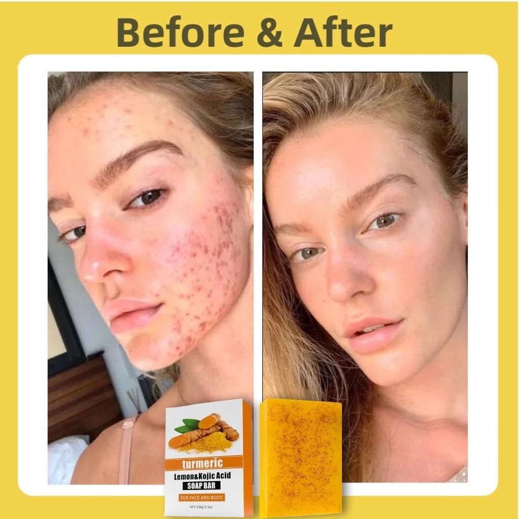 Jabón Natural de Limón y Cúrcuma Beauty Beauty - 3 Piezas