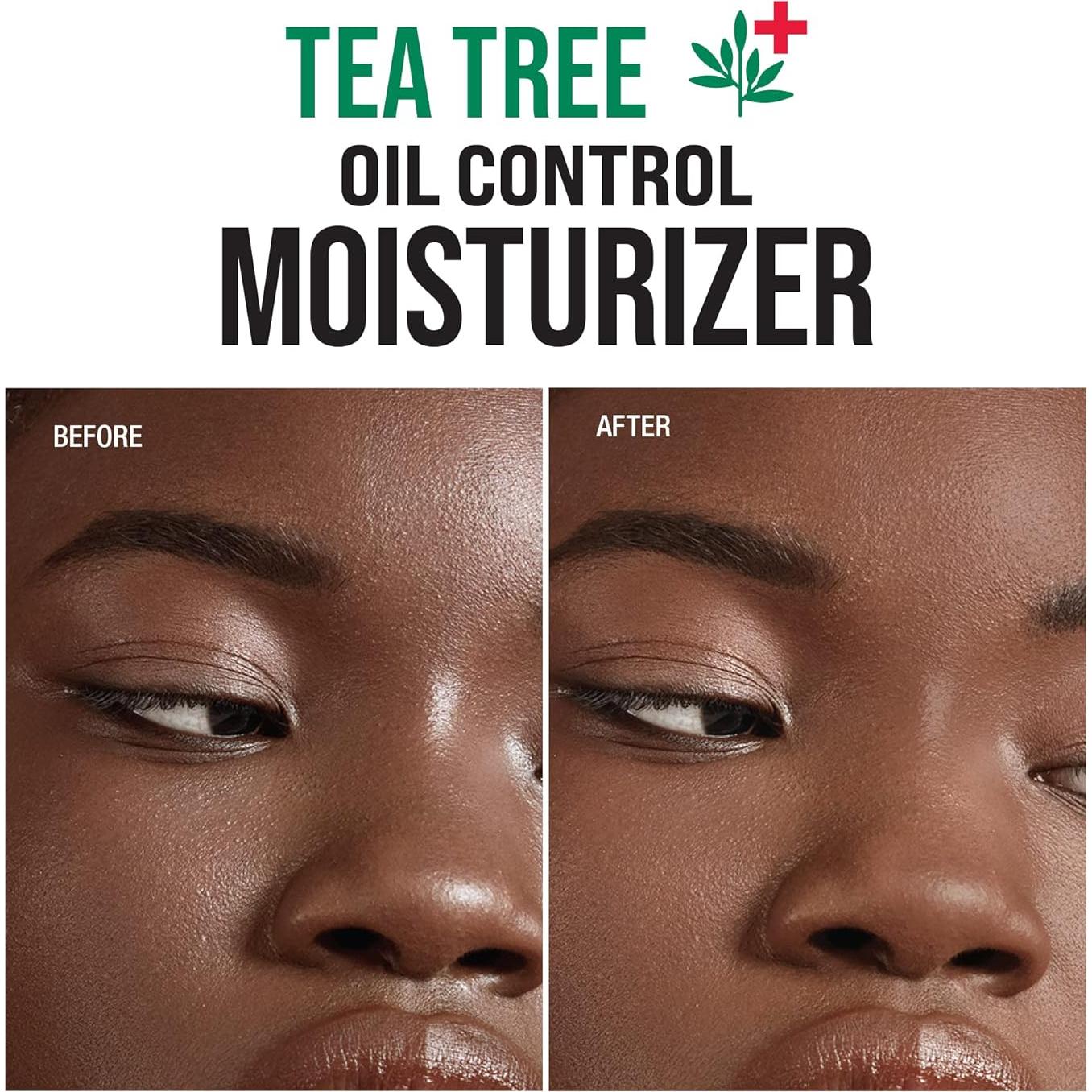 Hidratante Facial Kiss New York 100 ml Cica Aloe Árbol de Té