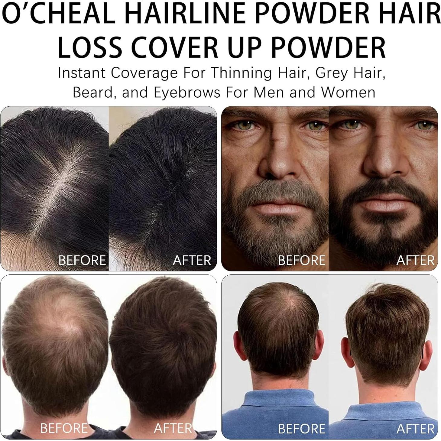 Polvo para Línea de Cabello O'CHEAL Negro 32g - Cobertura Instantánea