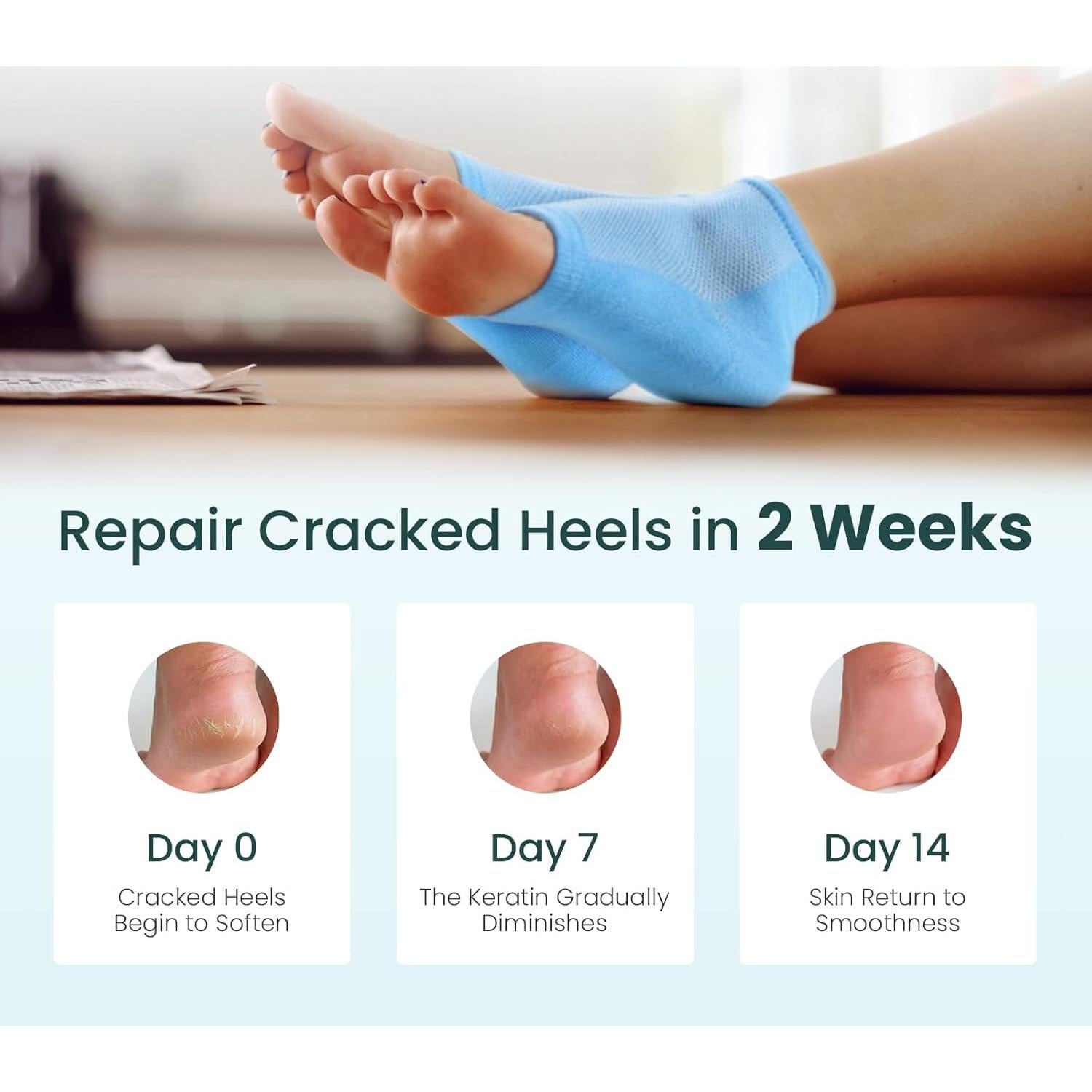 Calcetines Hidratantes Promifun para Talones Agrietados - 2 Pares