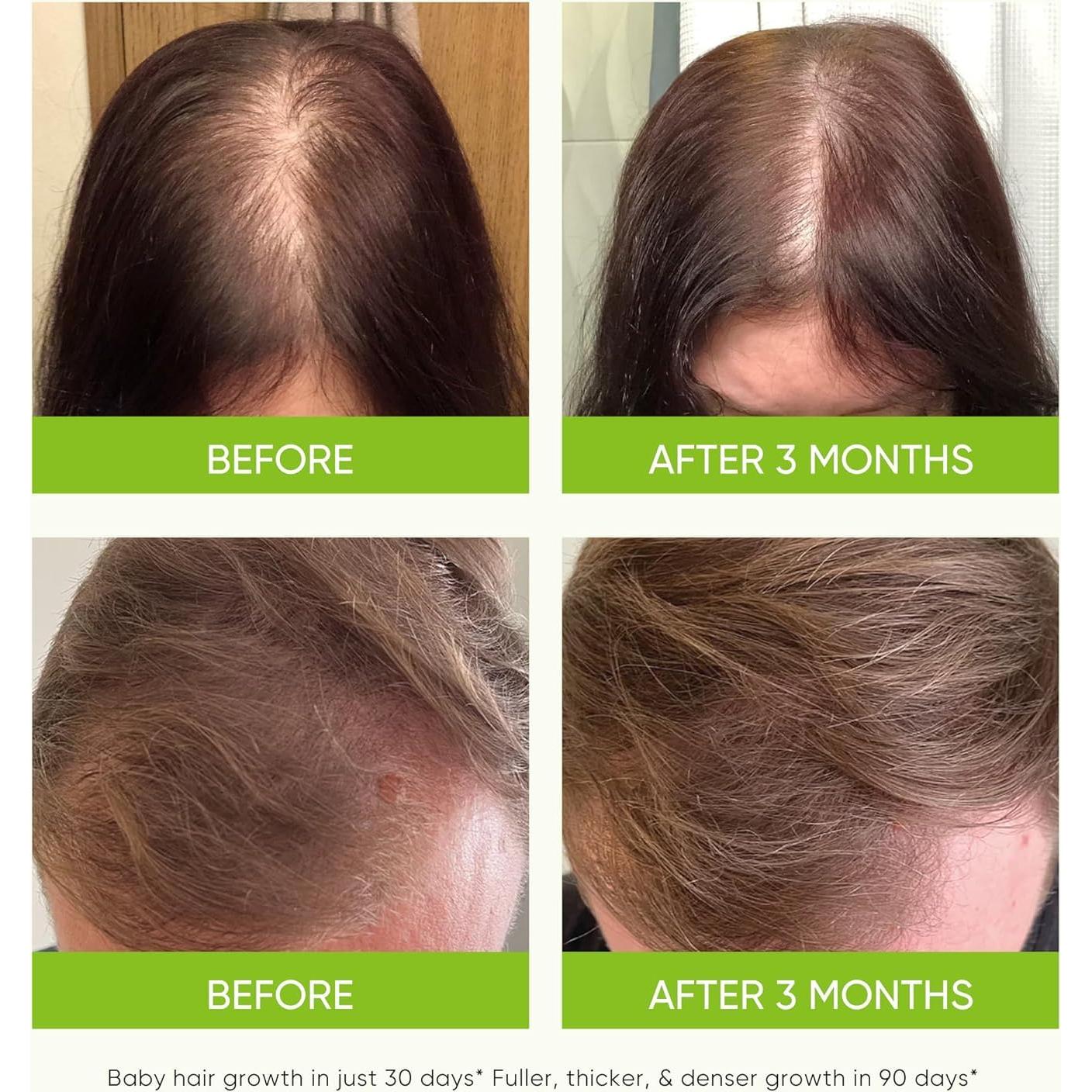 Spray Engrosador de Cabello Svvimer 79.83 ml - Romero y Biotina