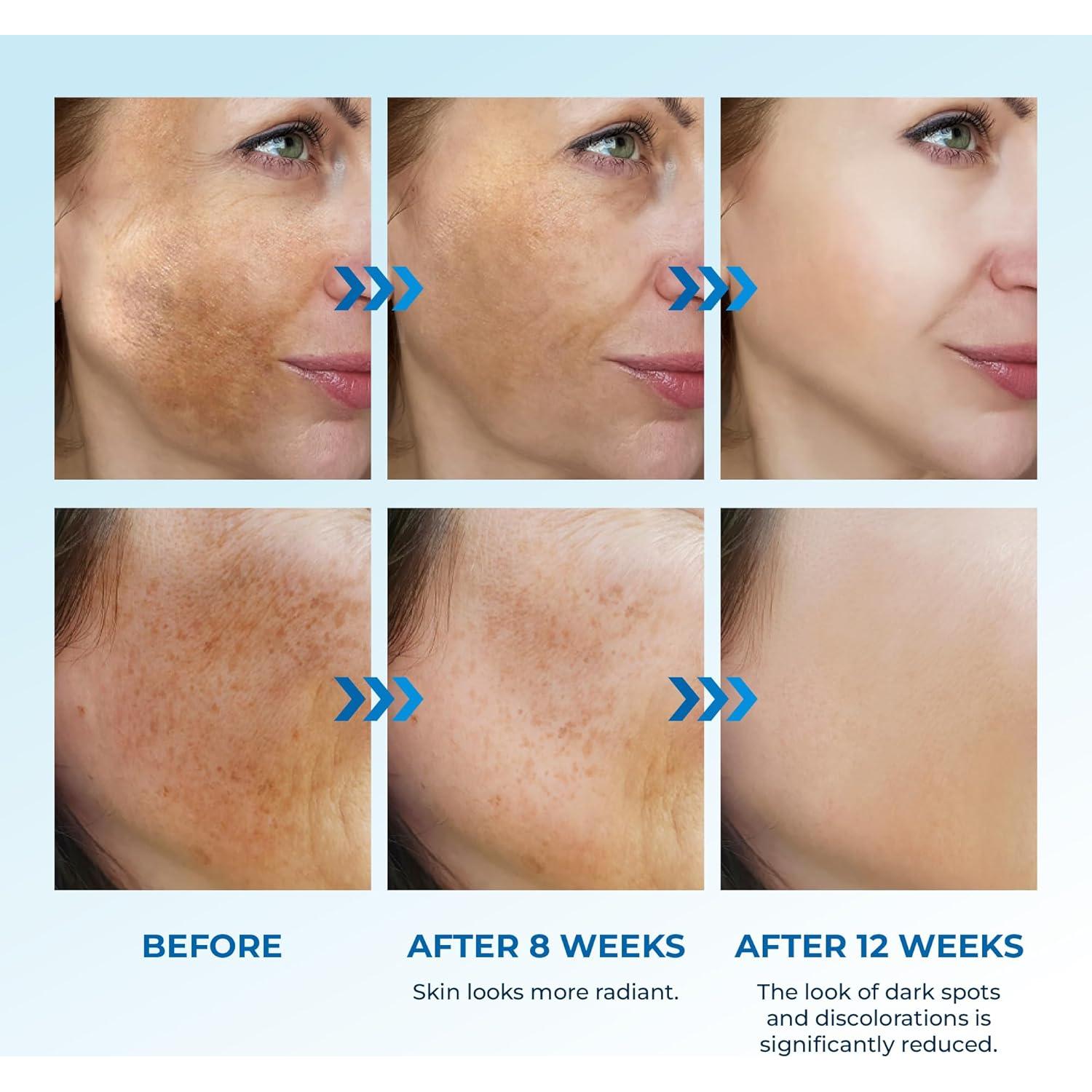 Suero para Manchas Oscuras Abera 20 ml - Hidratante y Antienvejecimiento