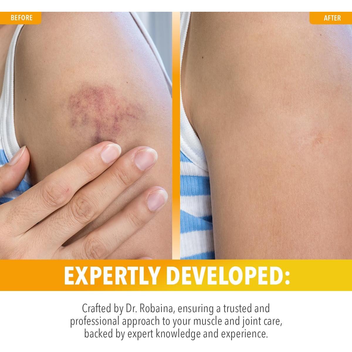 Roll-On Arnica Montana Dr. Robaina 85 g - Vitamina K, Secado Rápido