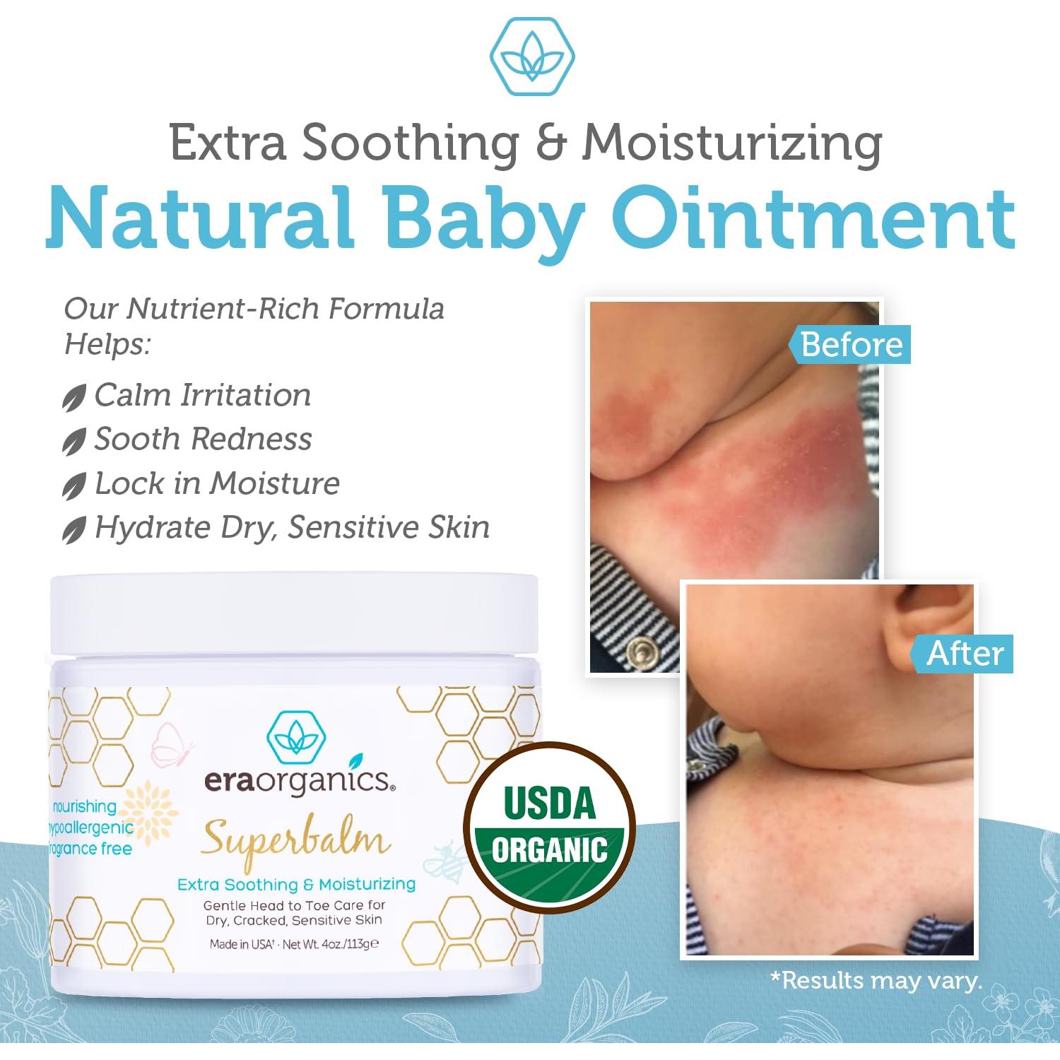 Ungüento Curativo Era Organics 113.4g para Bebés - Eccema