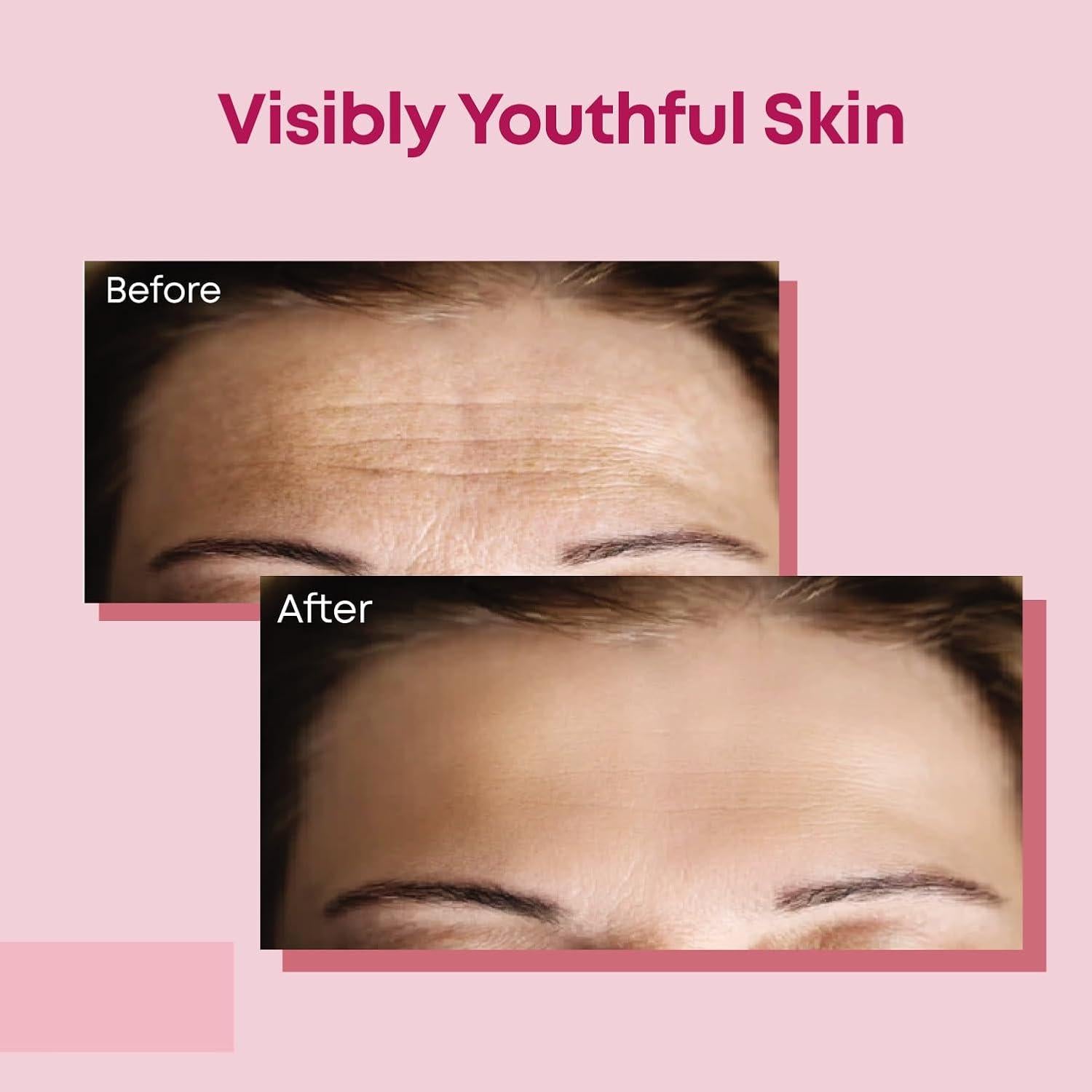 Parche Facial Antienvejecimiento Bayside - 20 Unidades para Arrugas