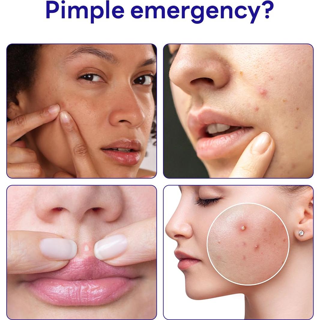 Mediheal Parche Antiacné Teatree 44 Unidades - Alivio y Equilibrio